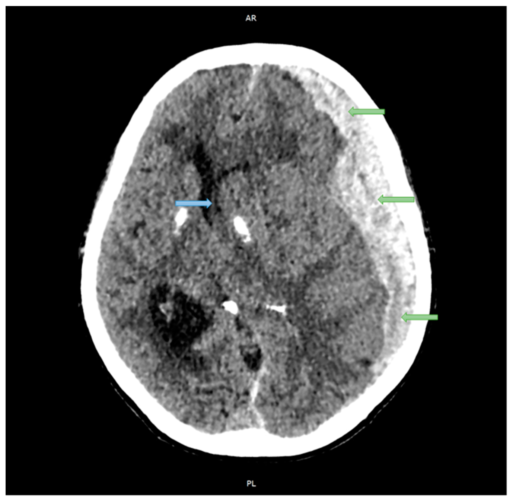 Applsci 14 02681 g004