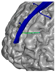 Applsci 14 02681 i017