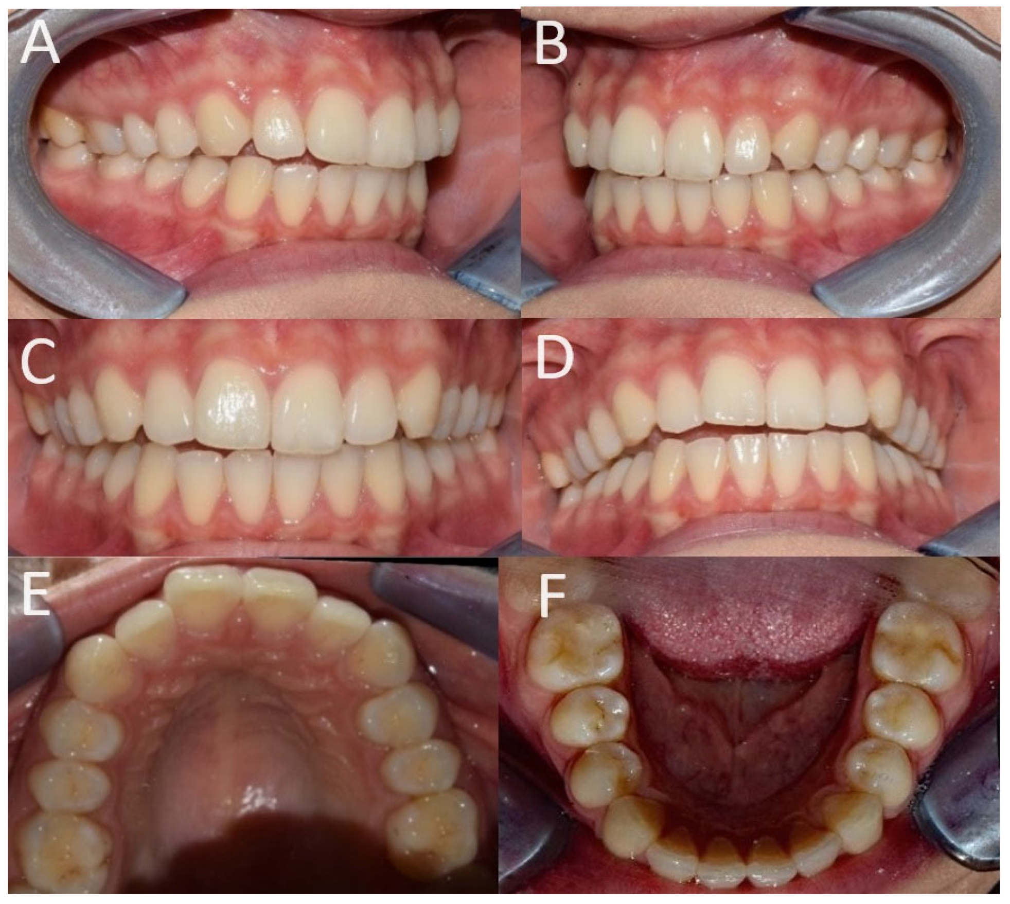 Applsci 14 02991 g002