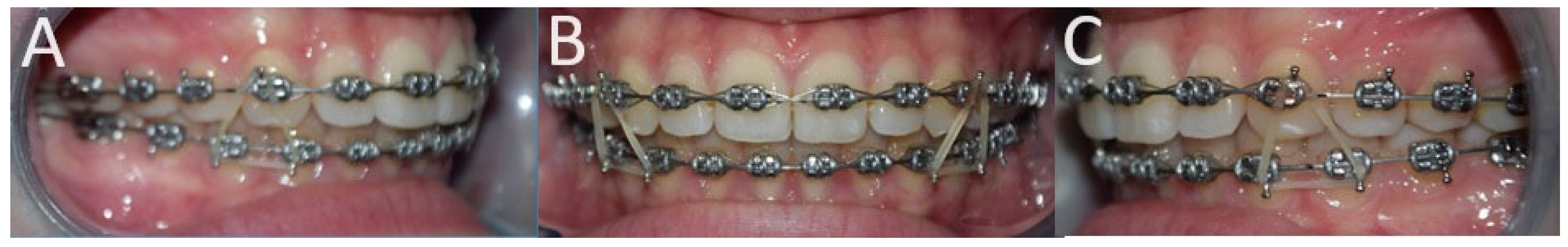 Applsci 14 02991 g006