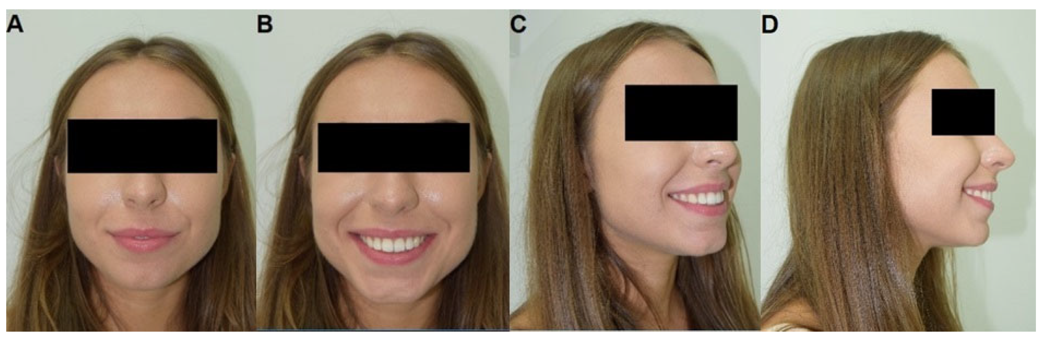 Applsci 14 02991 g008