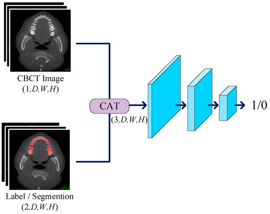 PPA-SAM: Plug-and-Play Adversarial Segment Anything Model