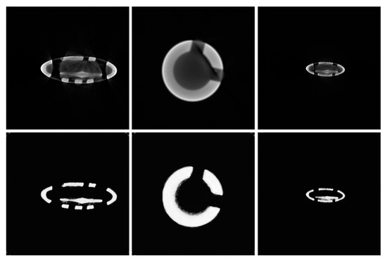 Metal Artifact Correction in Industrial CT Images Based on a Dual ...