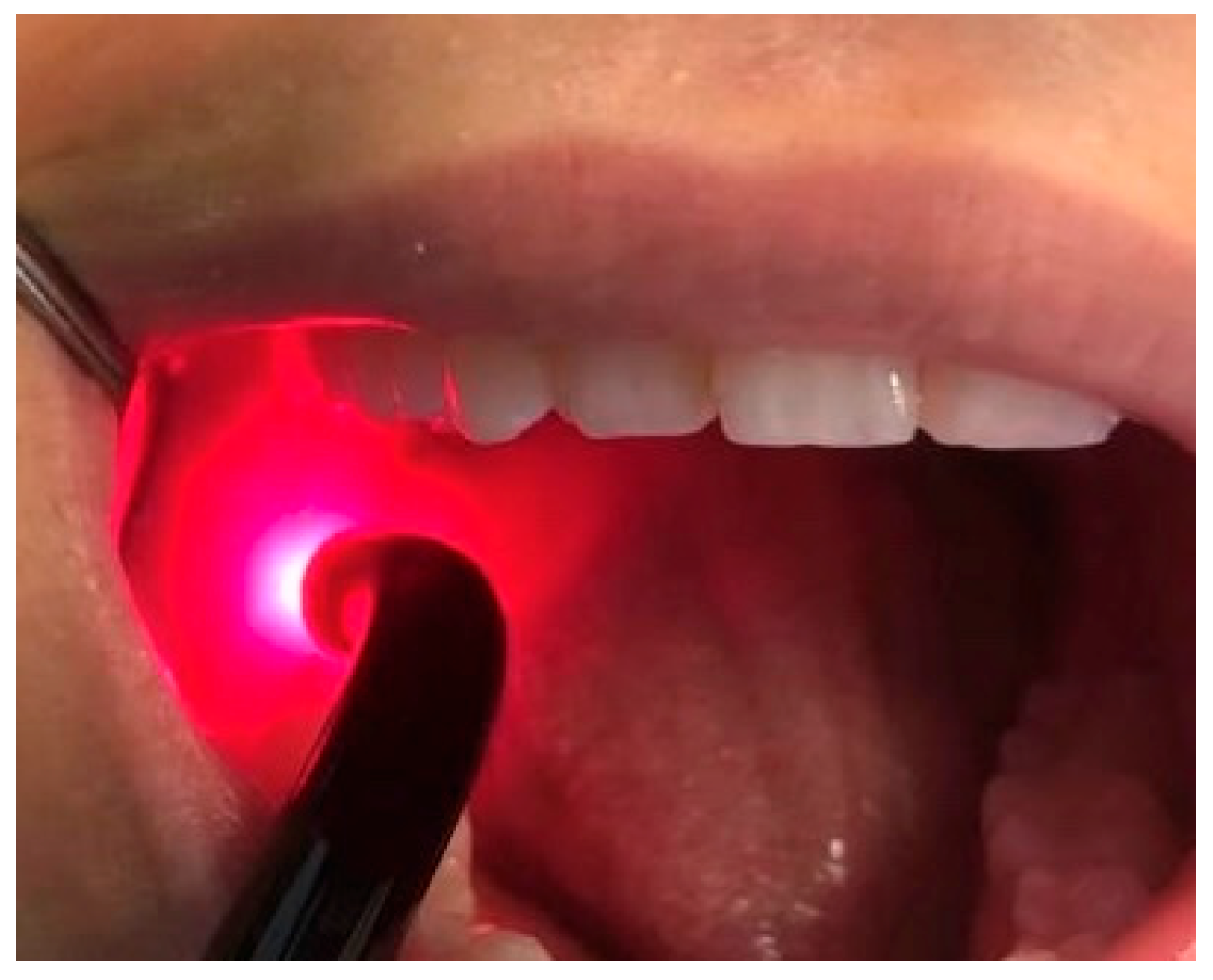 Applsci 14 03268 g002