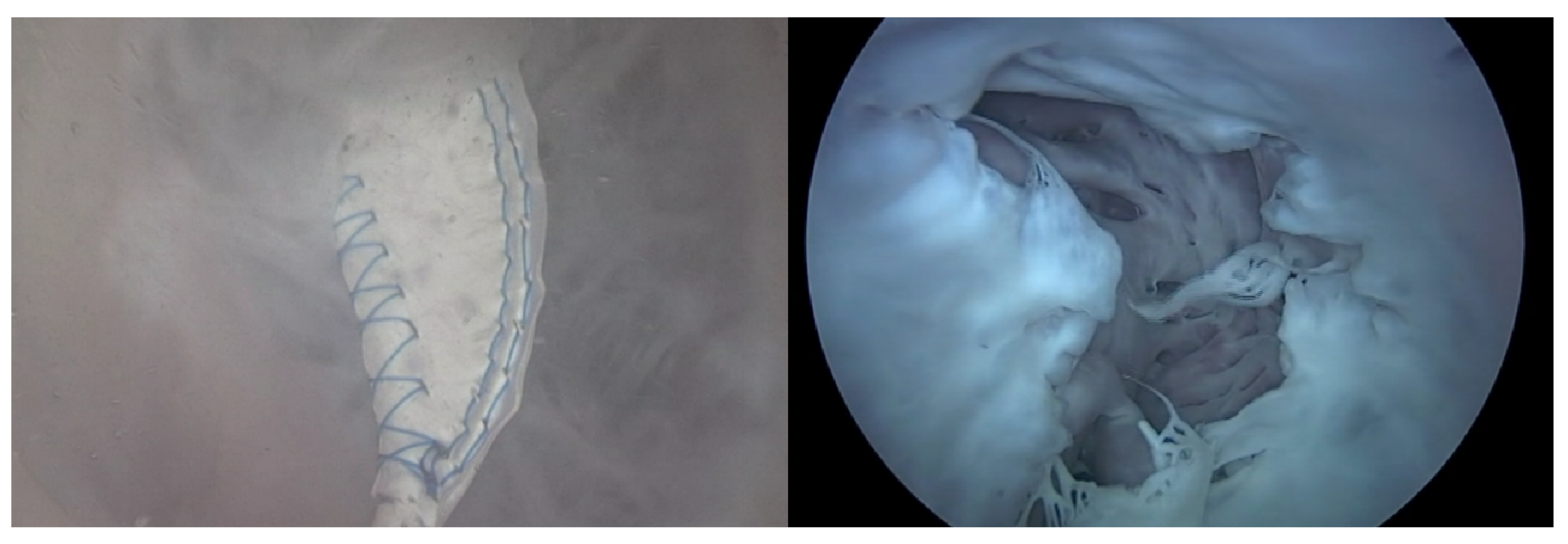 Applsci 14 03307 g006