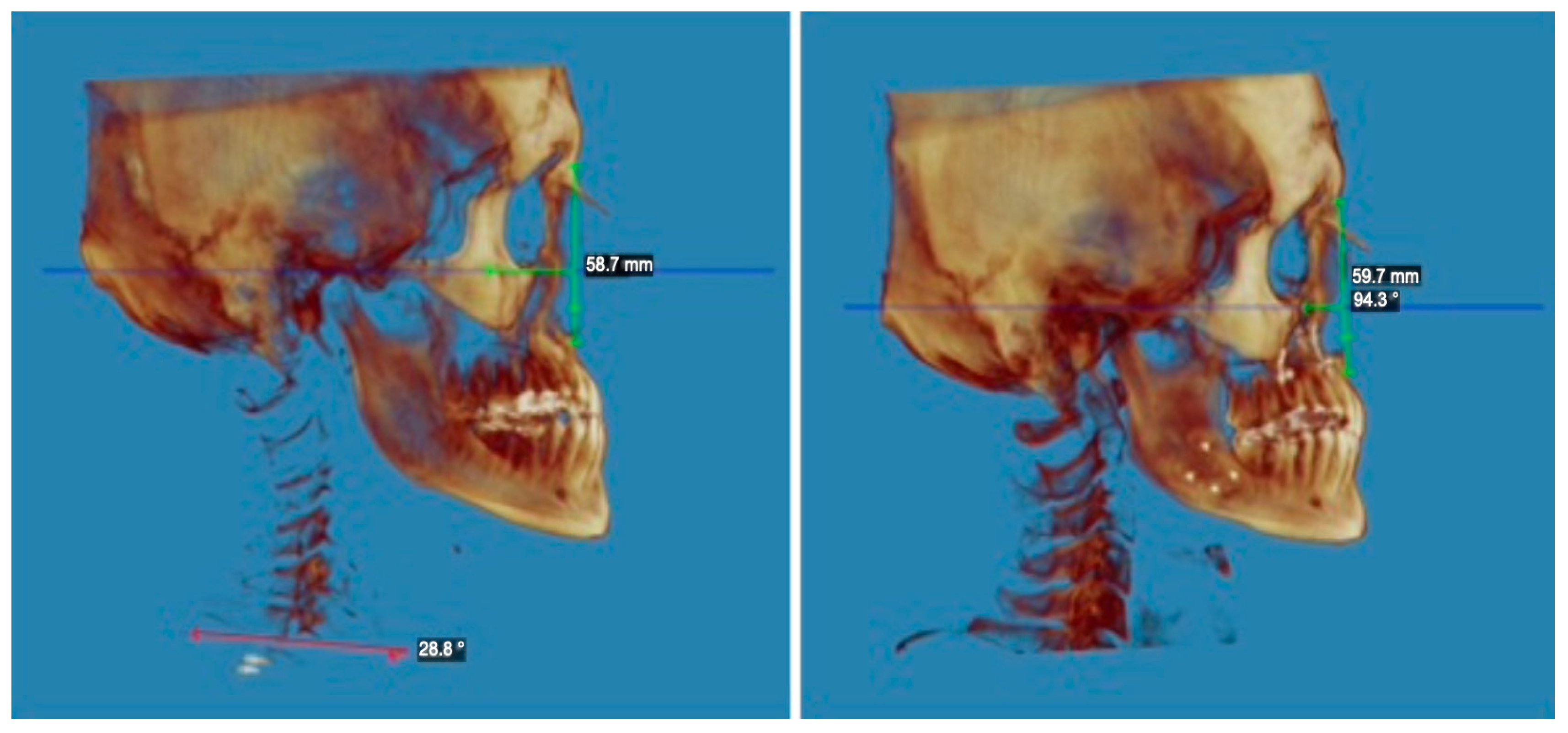 Applsci 14 03529 g002 Applsci 14 03529 g002