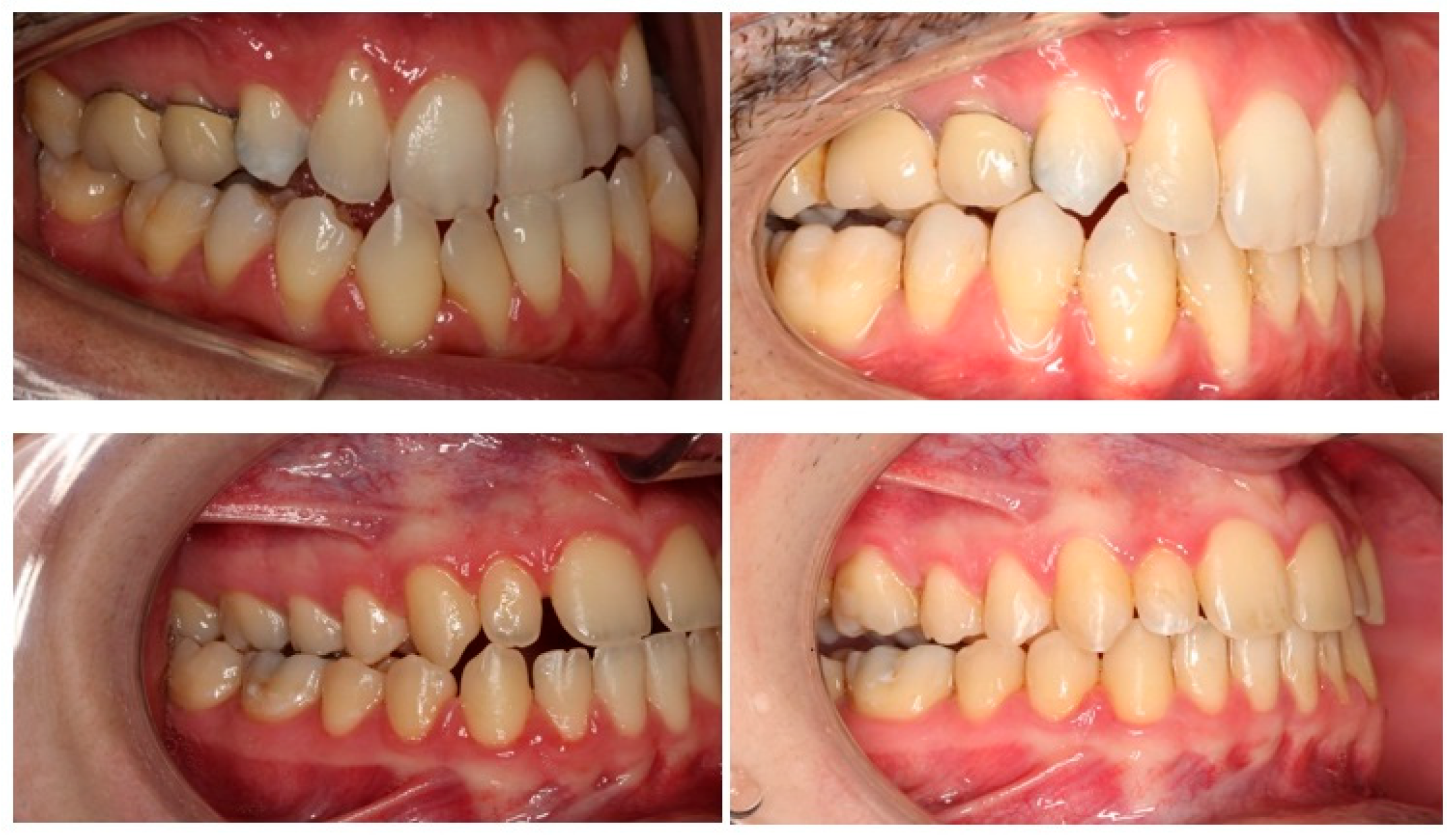 Applsci 14 03529 g004 Applsci 14 03529 g004