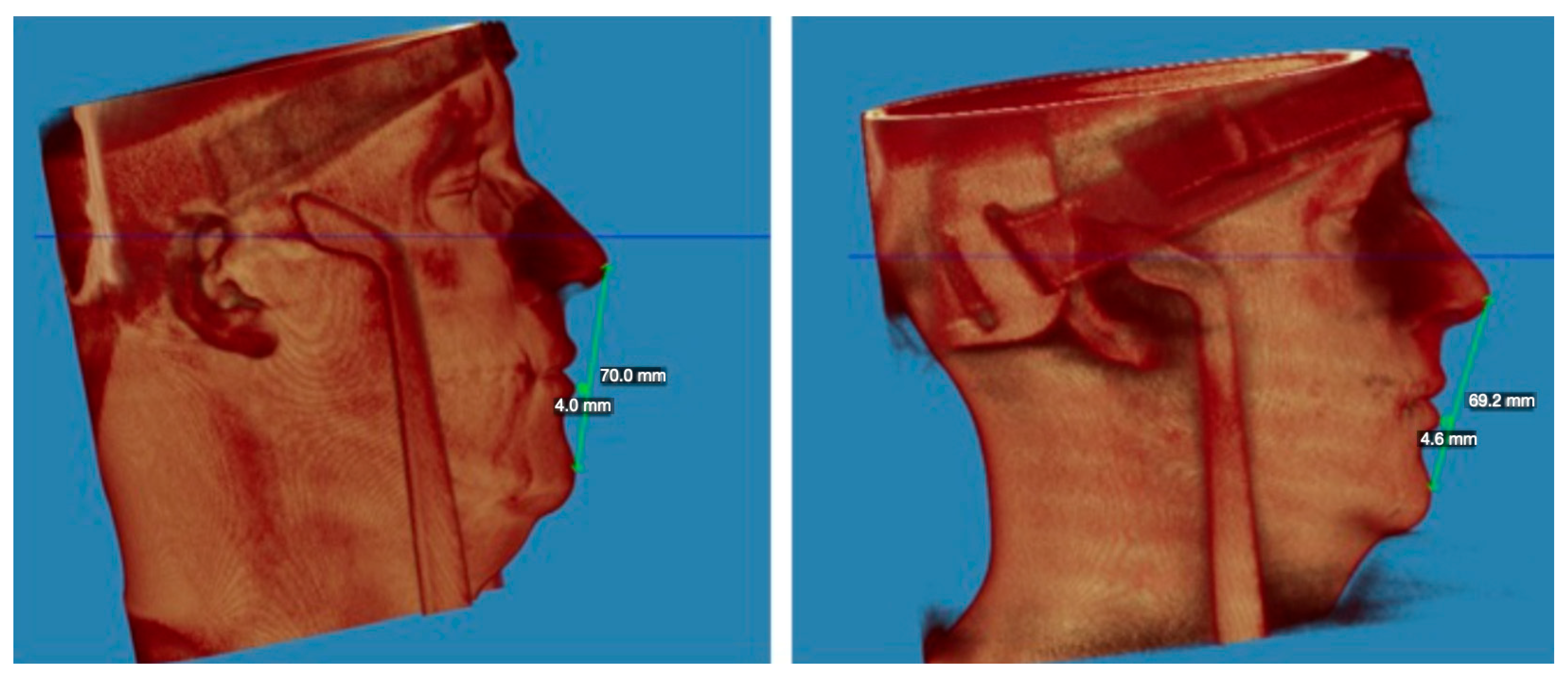 Applsci 14 03529 g007 Applsci 14 03529 g007