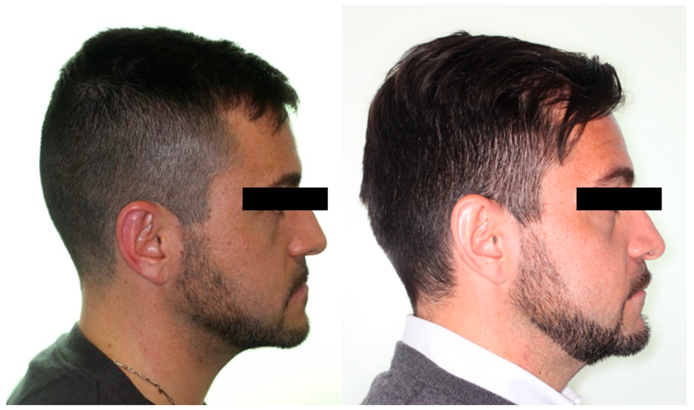 Applsci 14 03529 g008 Applsci 14 03529 g008