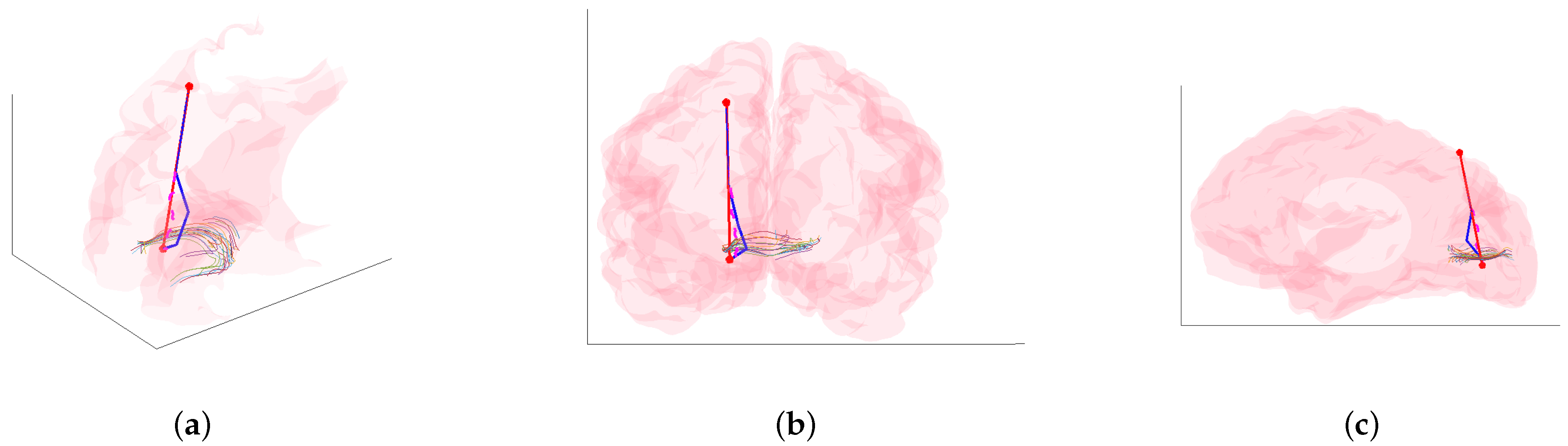 Applsci 14 03687 g006