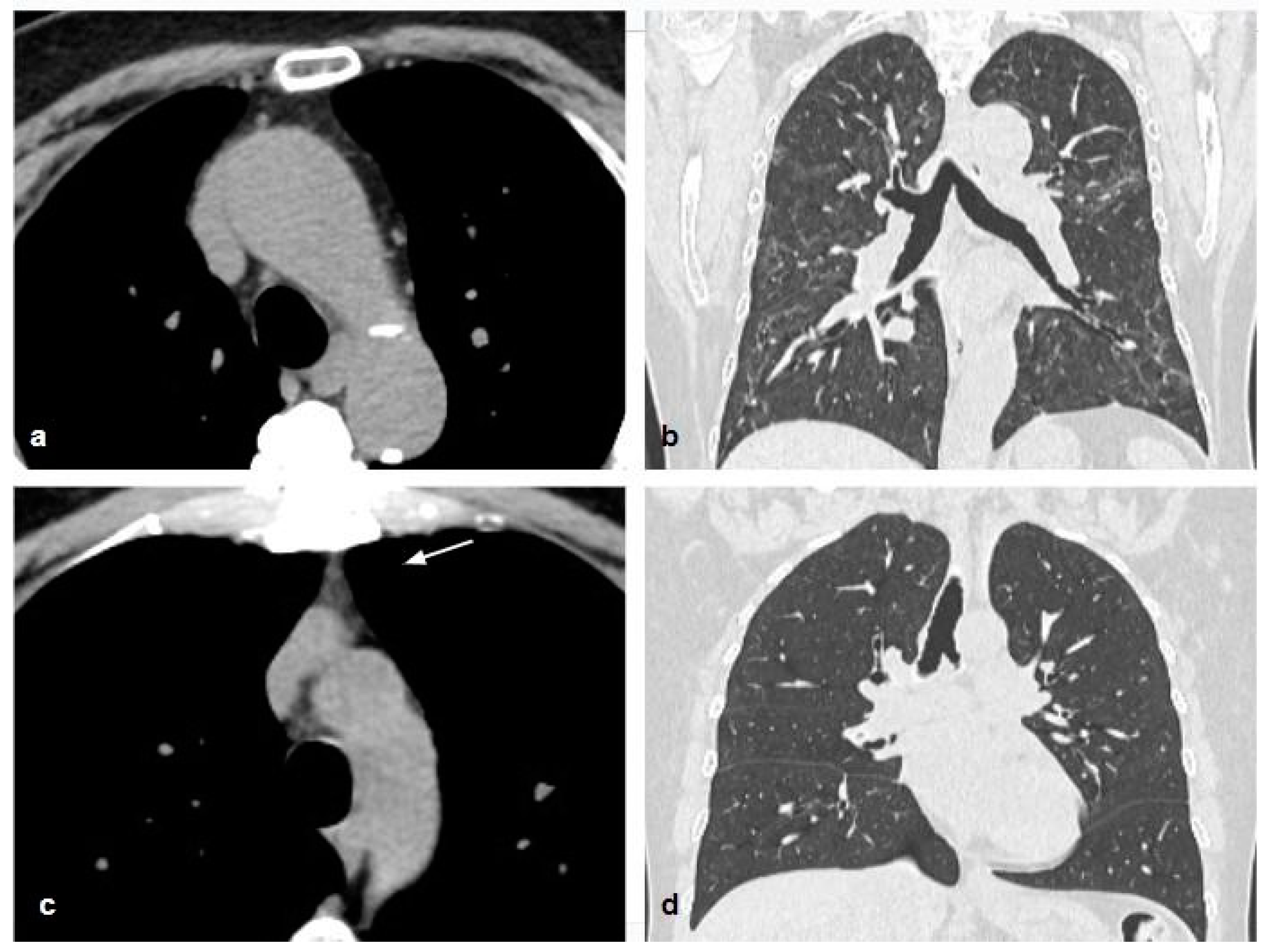 Applsci 14 03930 g005