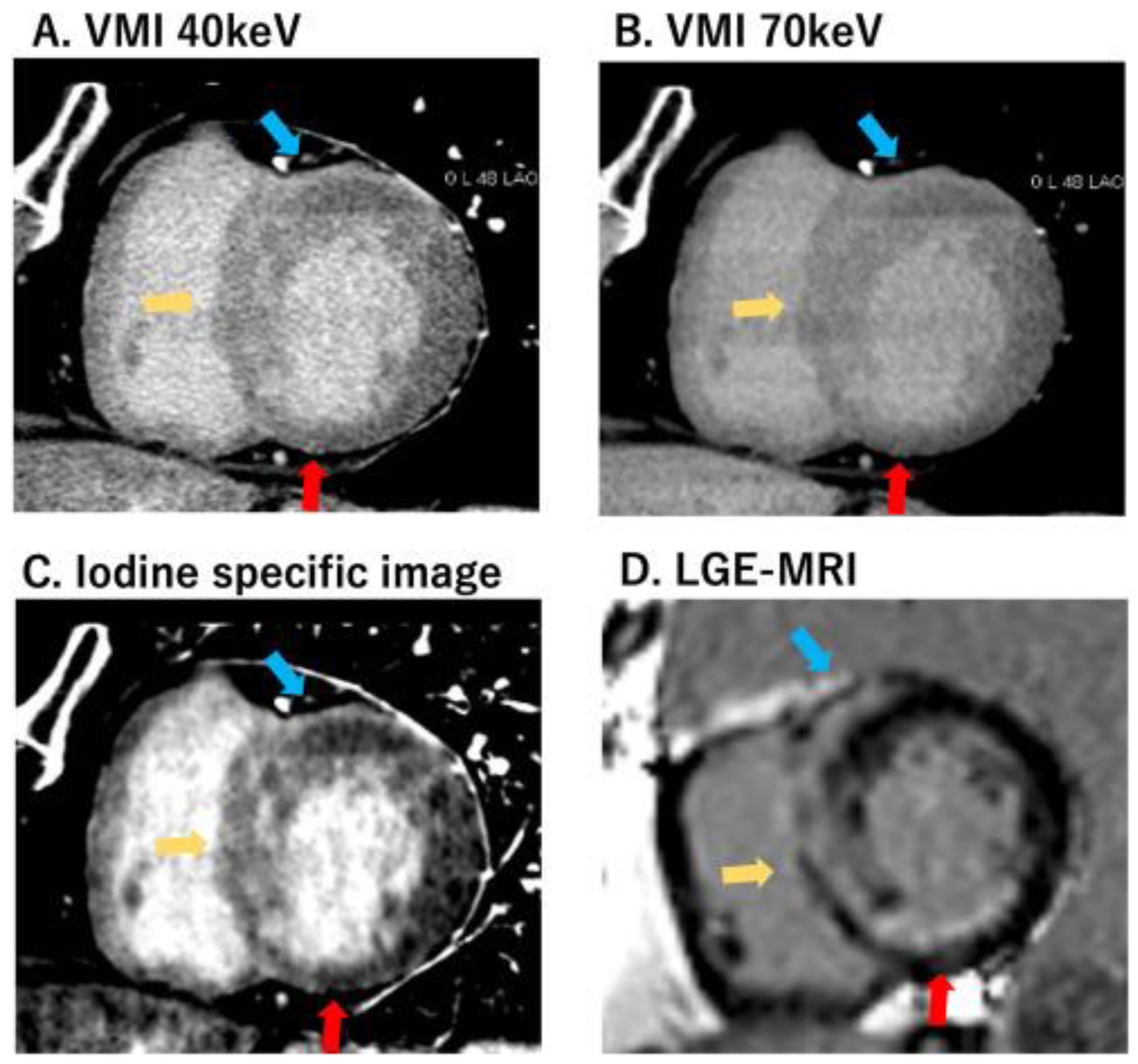 Applsci 14 04275 g001