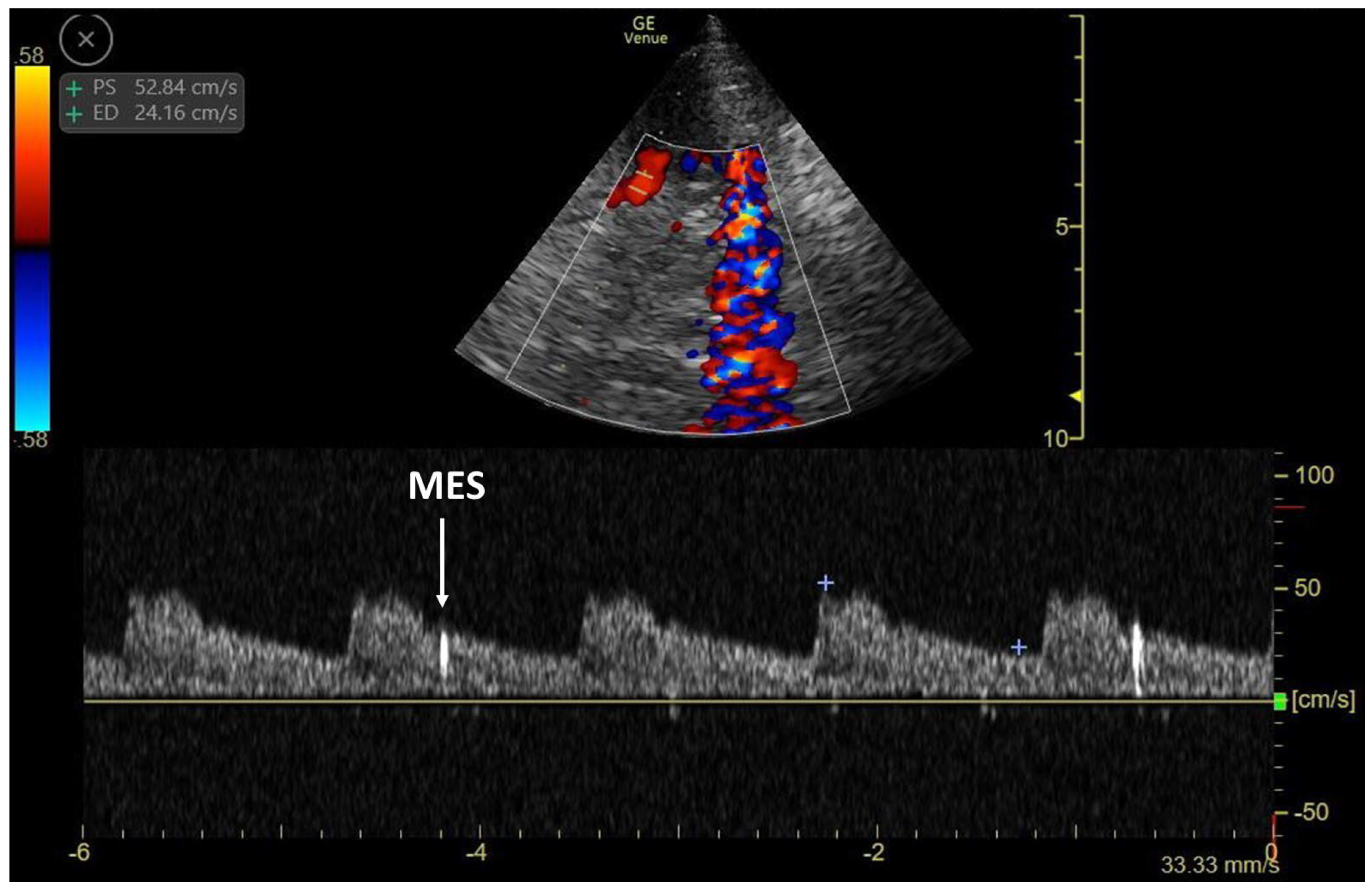 Applsci 14 04590 g007