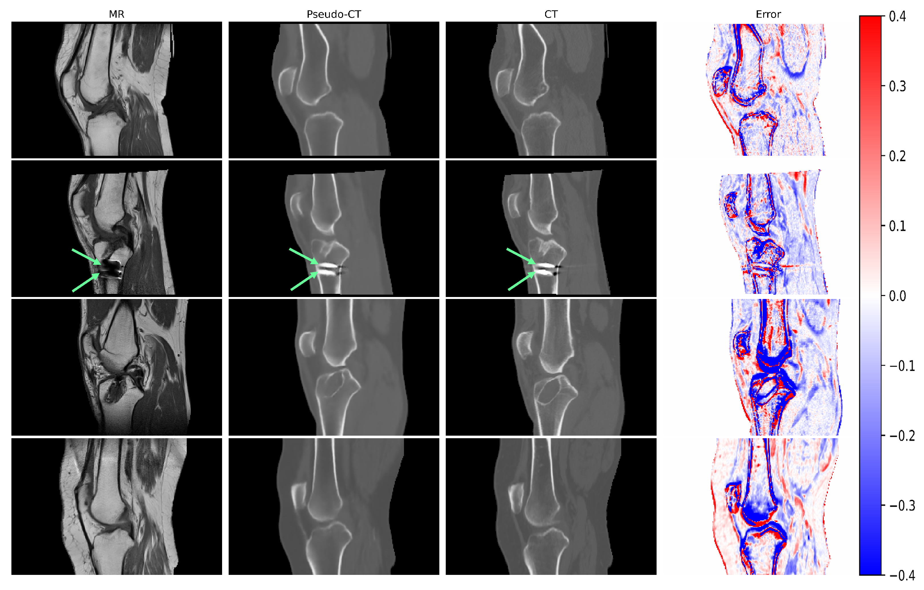 Applsci 14 04655 g003