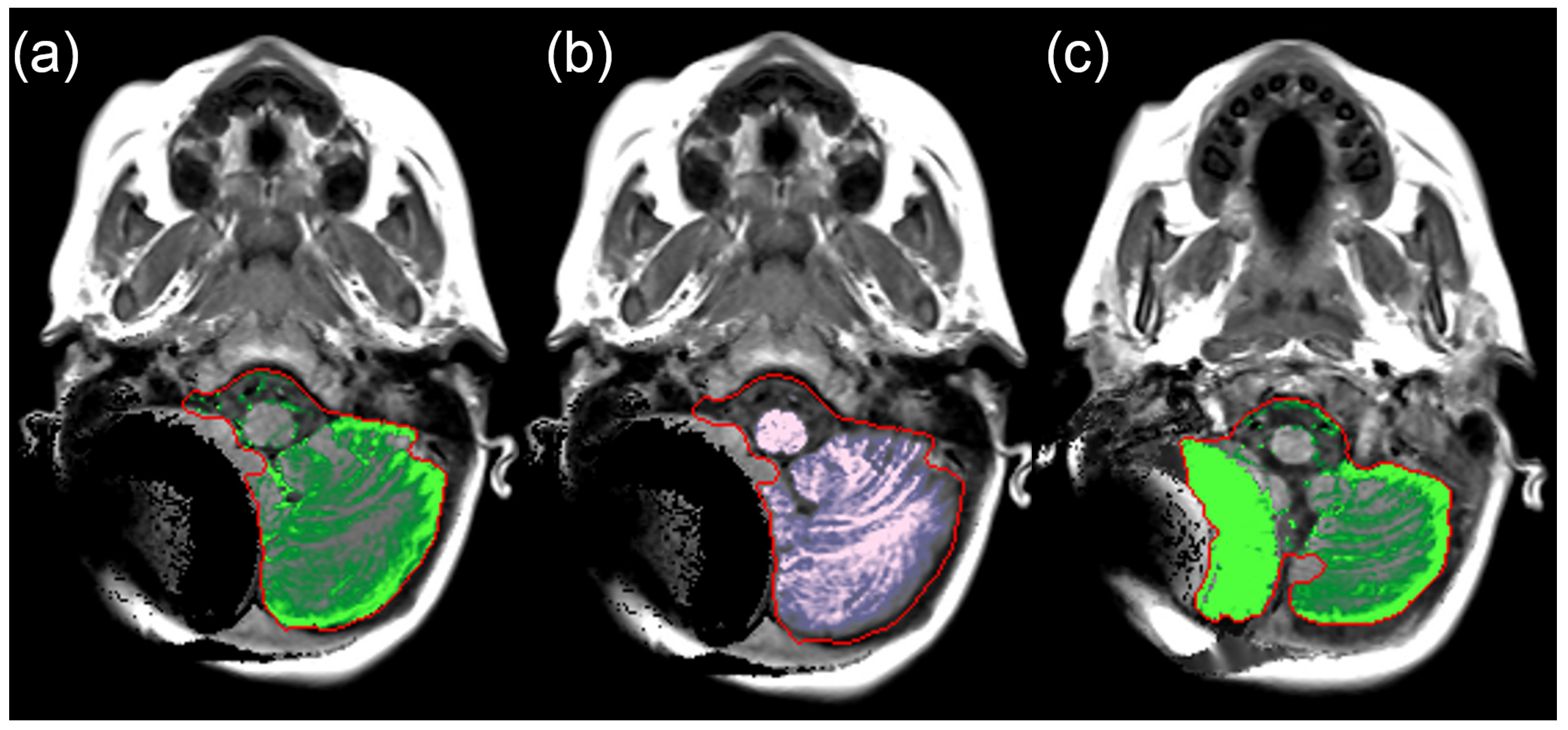 Applsci 14 04751 g011