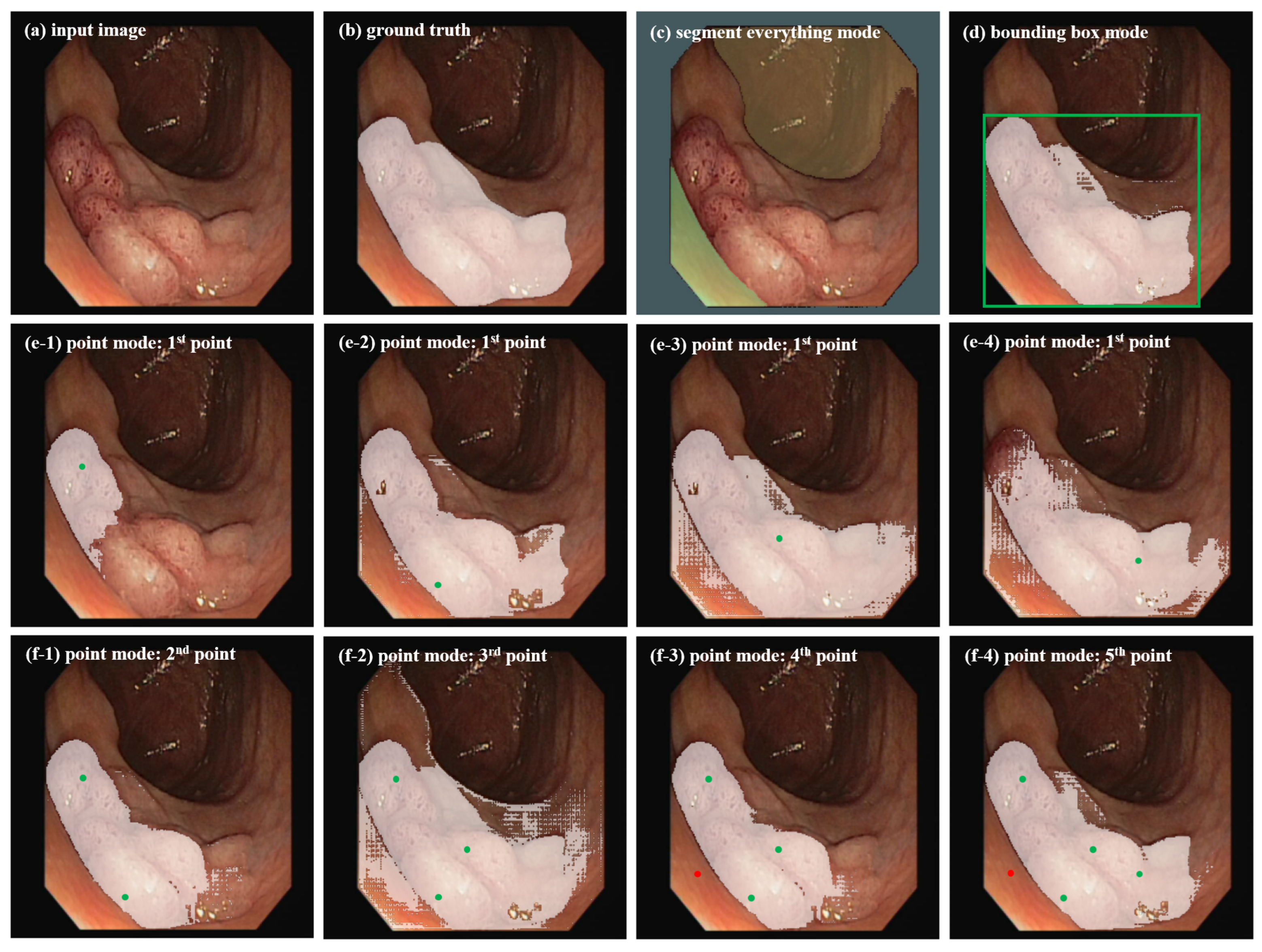 Applsci 14 05007 g001