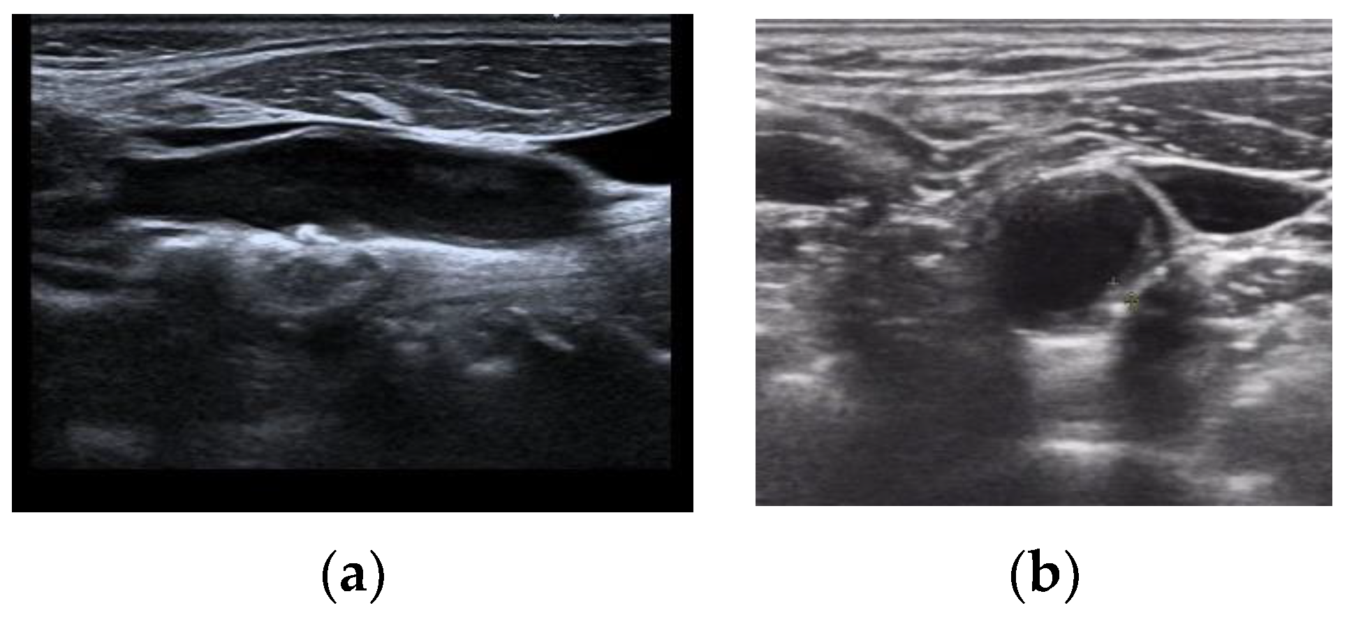 Applsci 14 05051 g001