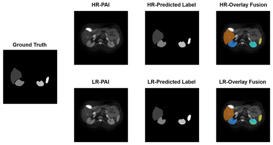 Deep Learning-Based Super-Resolution Reconstruction and