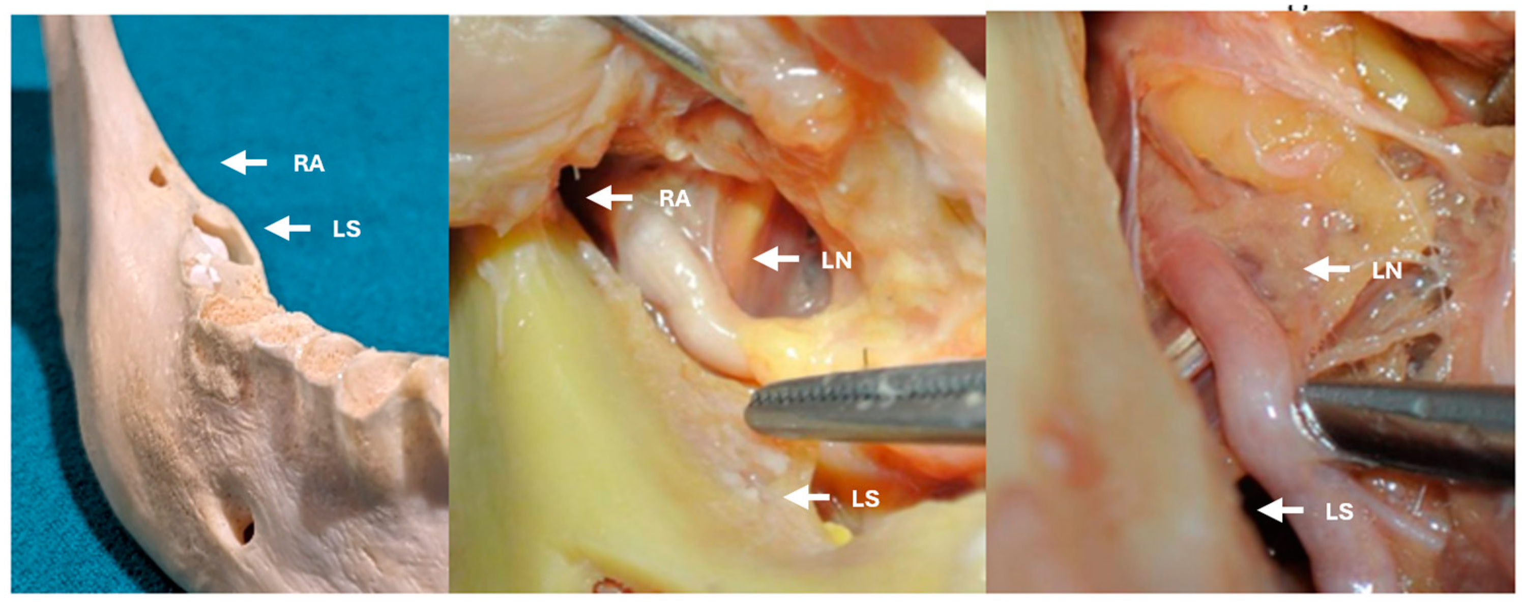Applsci 14 05835 g001