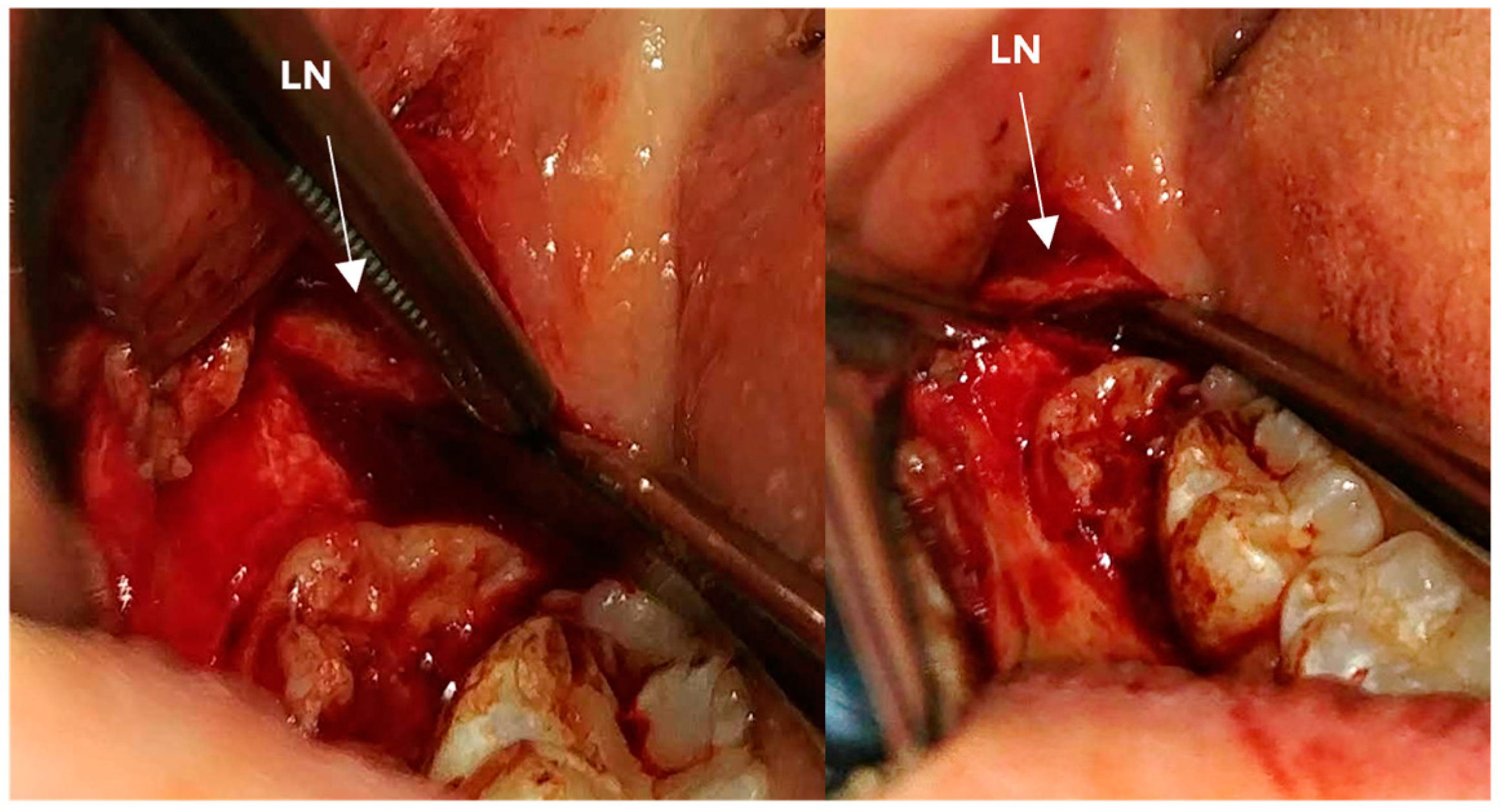 Applsci 14 05835 g005