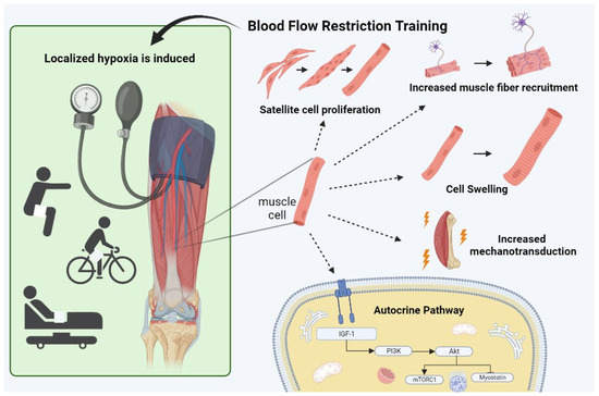 Blood Flow Restriction Exercise as a Novel Conservative Standard 