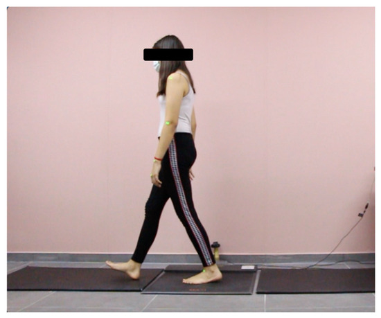 Arm Swing Movements during Walking as an Early Predictor of Multiple ...