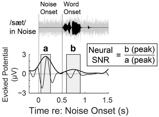 Cortical and Subjective Measures of Individual Noise Tolerance Predict ...