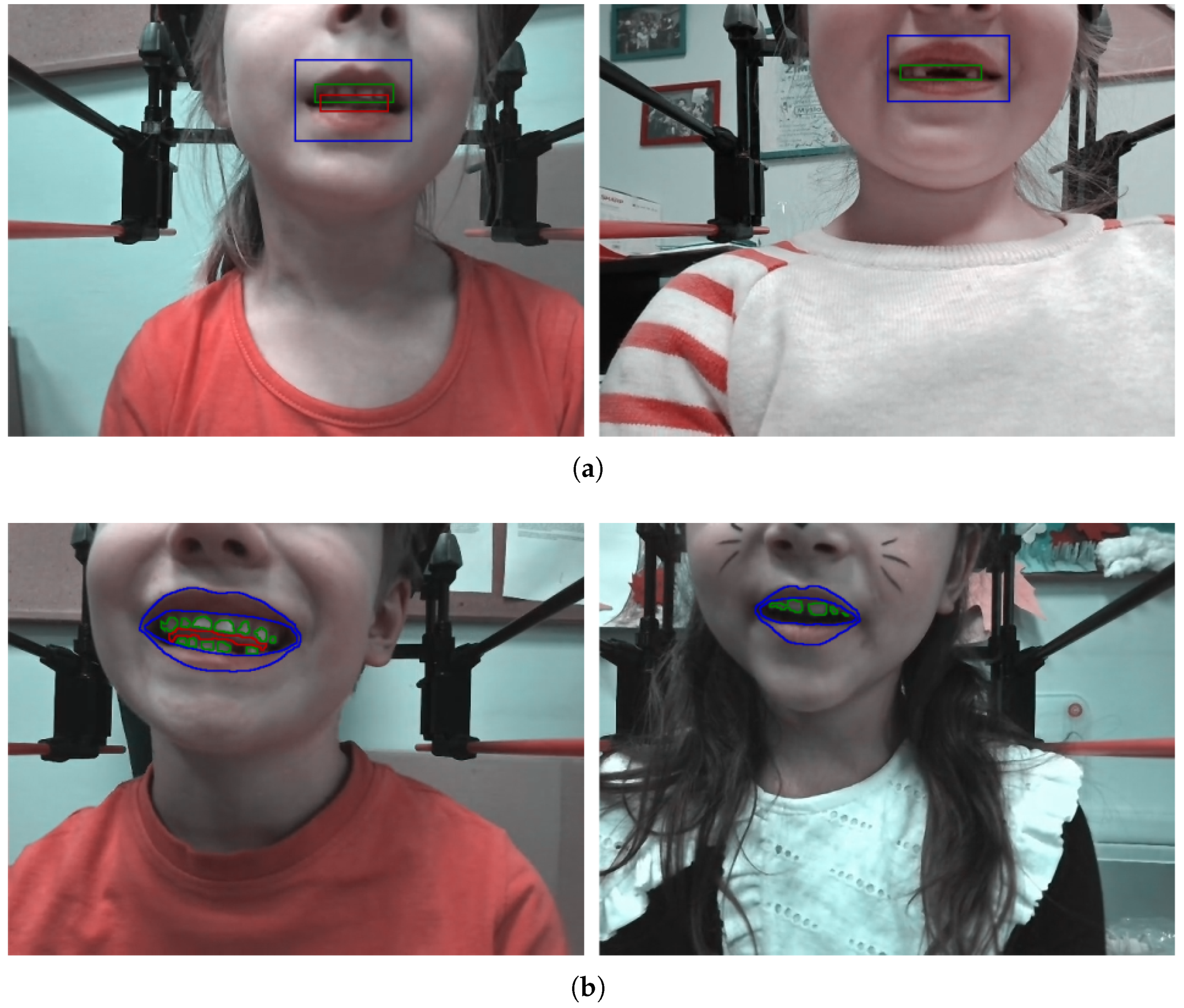 Applsci 14 07146 g003