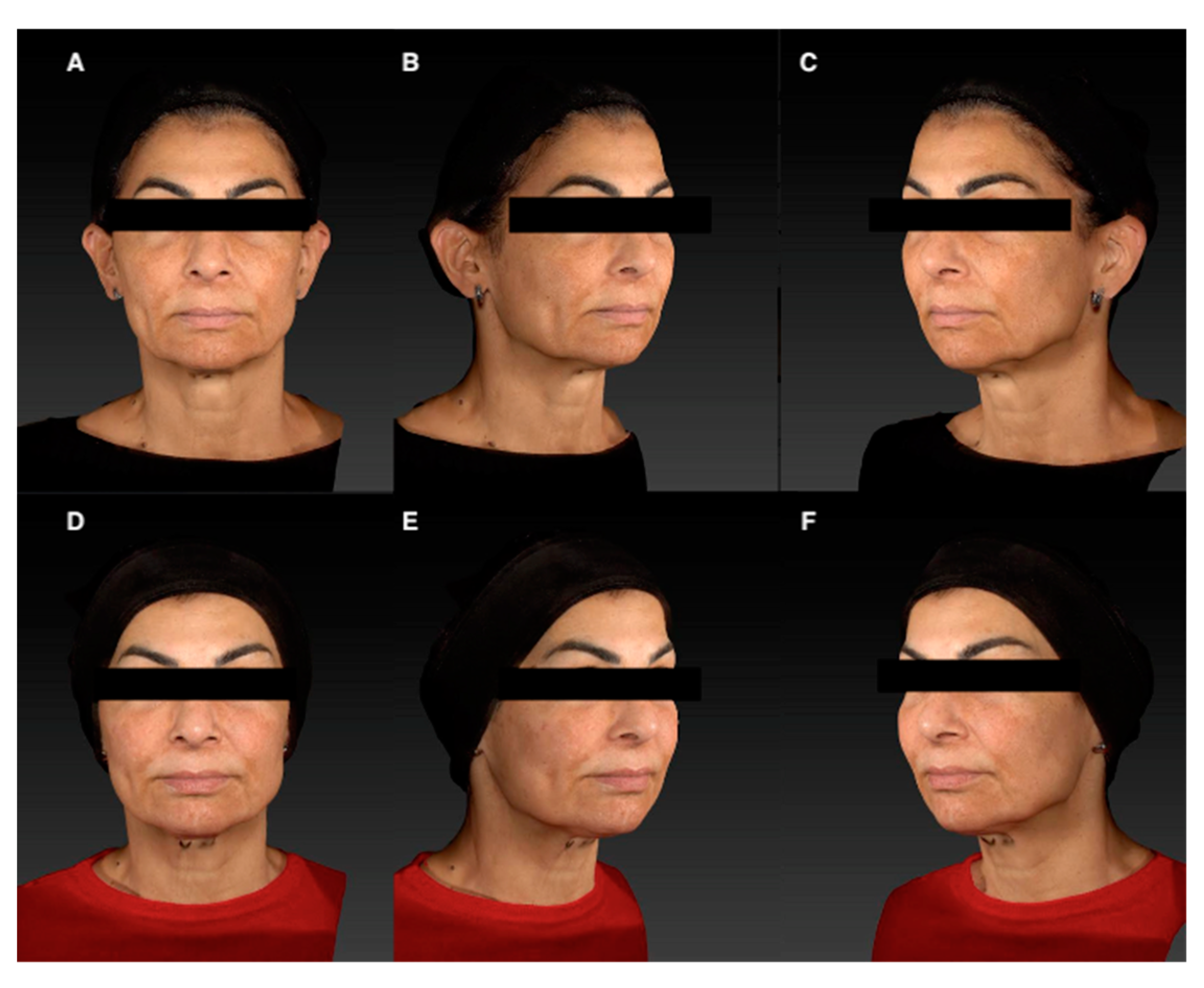 Applsci 14 07252 g002