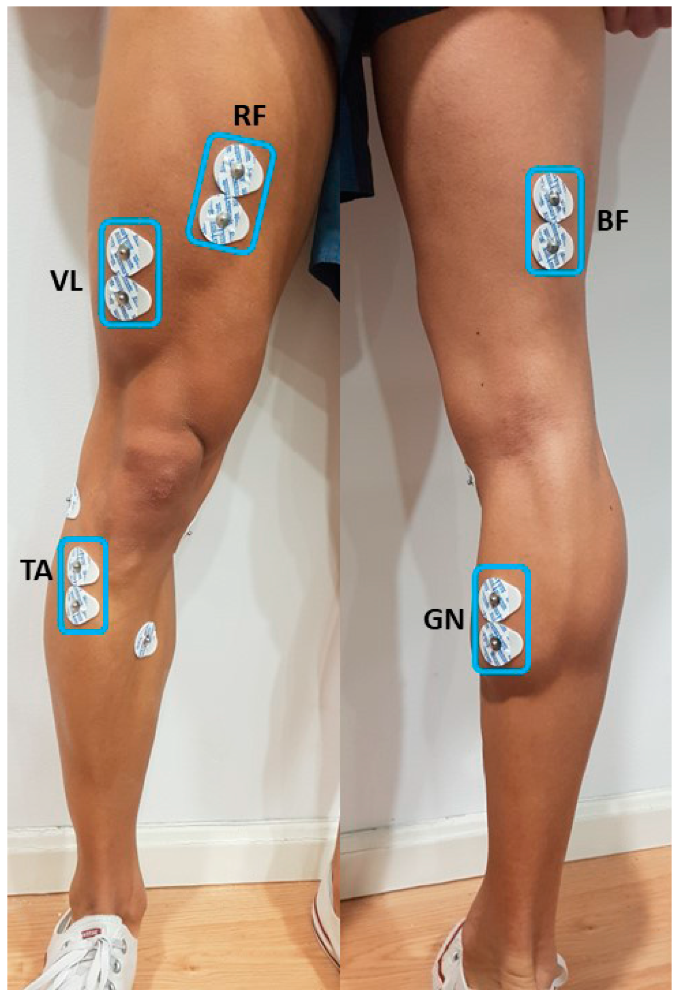 Applsci 14 07390 g002