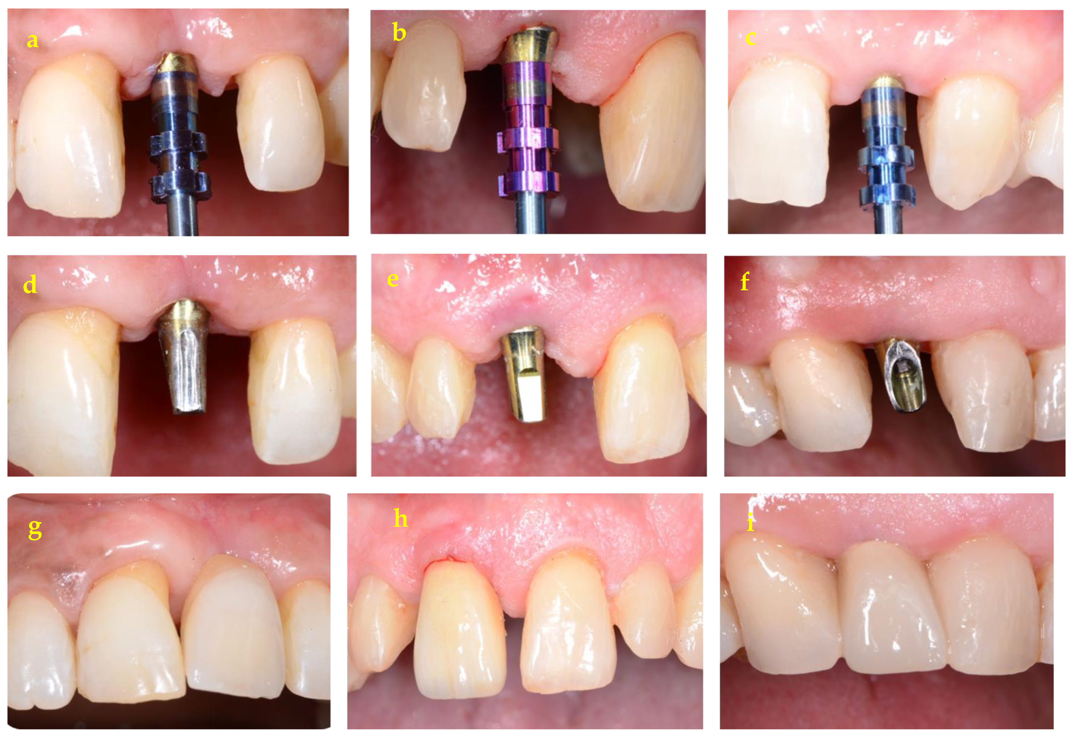 Applsci 14 07568 g002