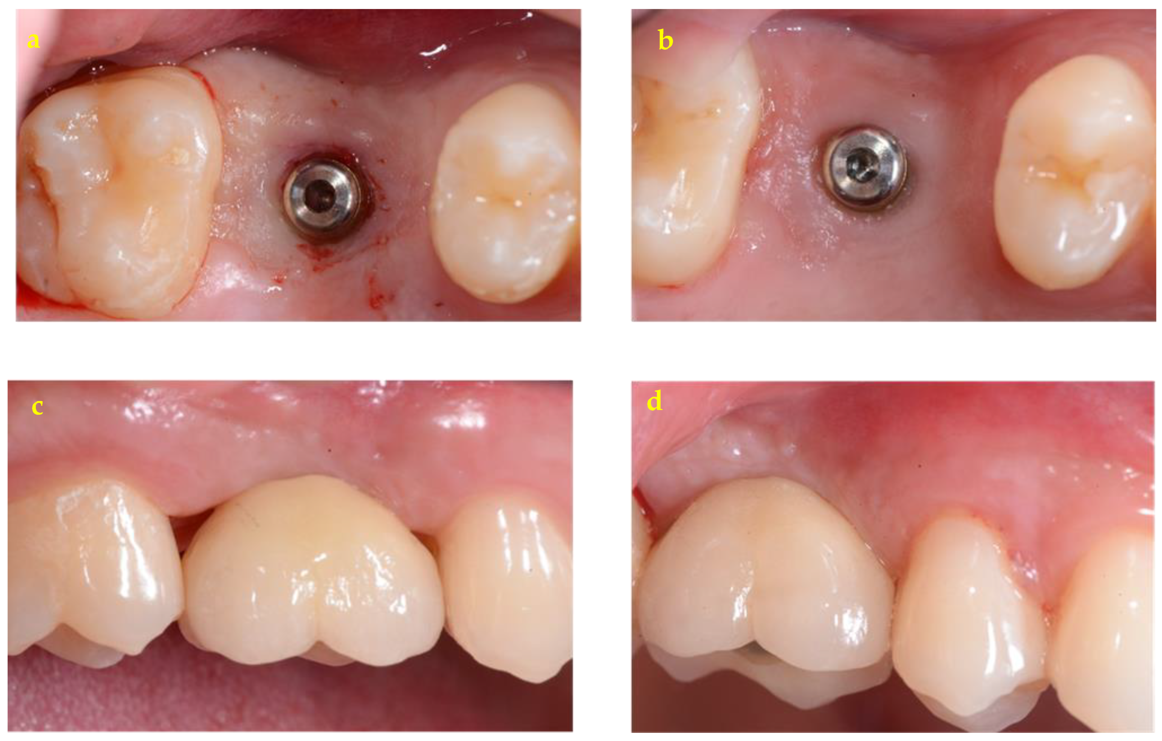 Applsci 14 07568 g003