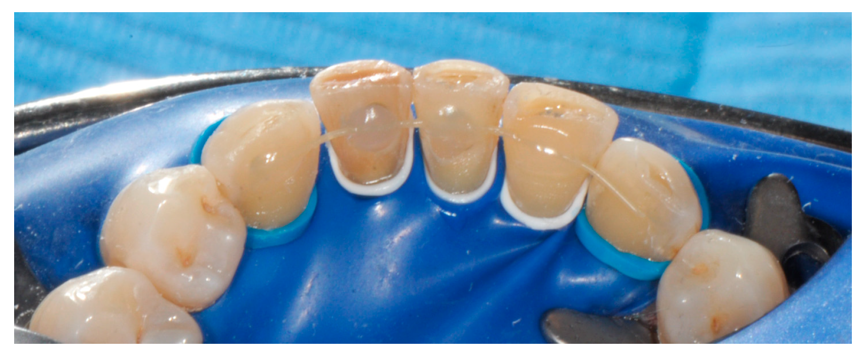 Applsci 14 07806 g007 Applsci 14 07806 g007