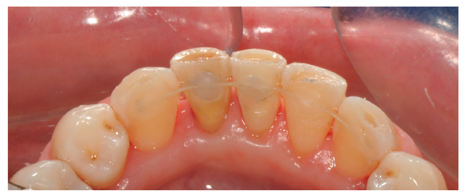 Applsci 14 07806 g009 Applsci 14 07806 g009