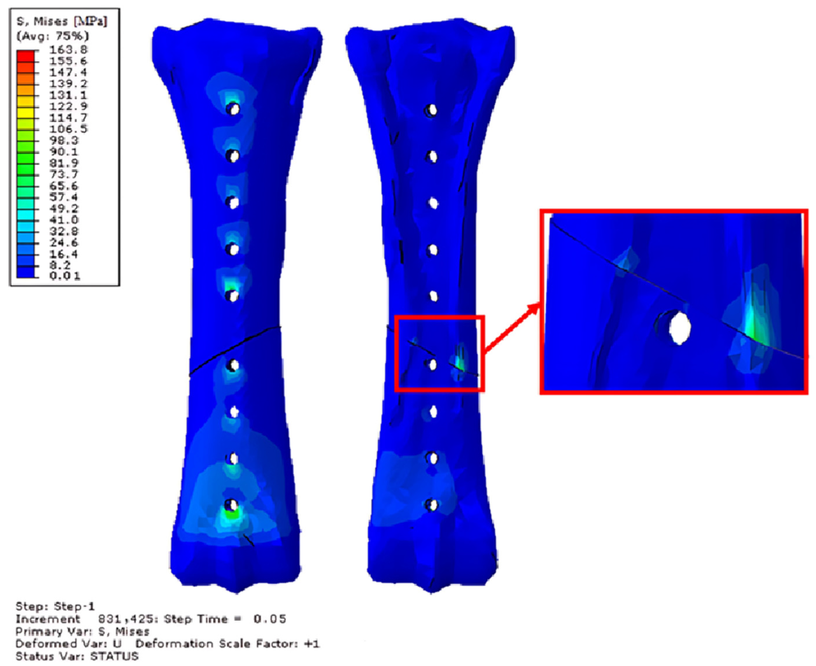 Applsci 14 07976 g017 Applsci 14 07976 g017