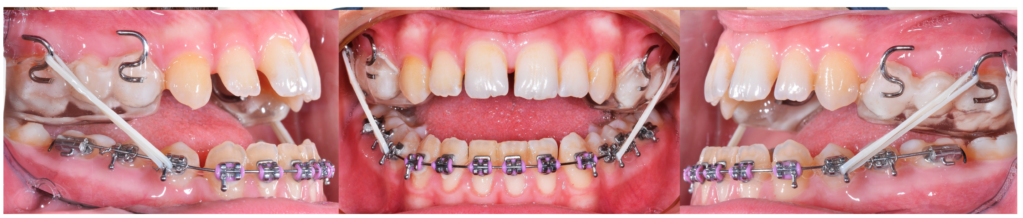 Applsci 14 08095 g008 Applsci 14 08095 g008