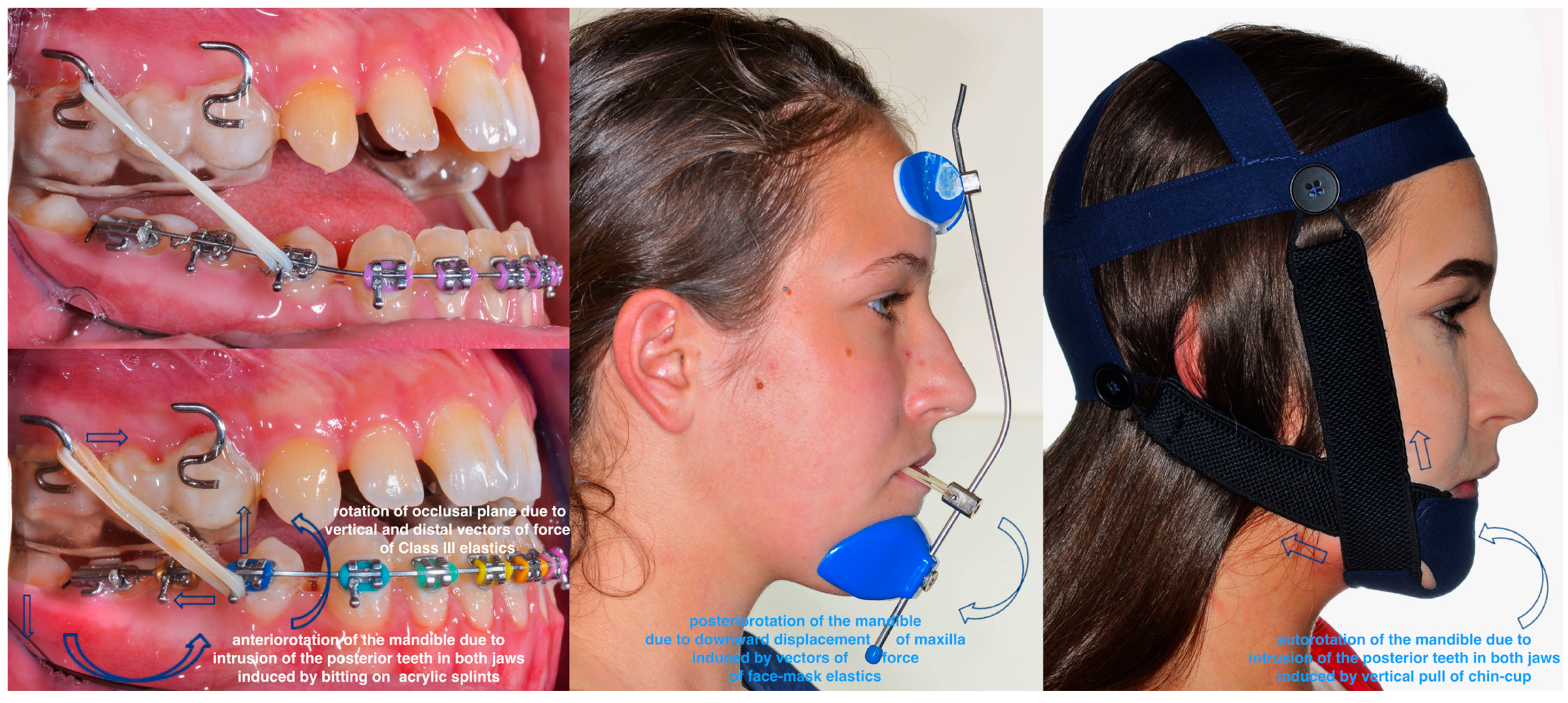 Applsci 14 08095 g009 Applsci 14 08095 g009