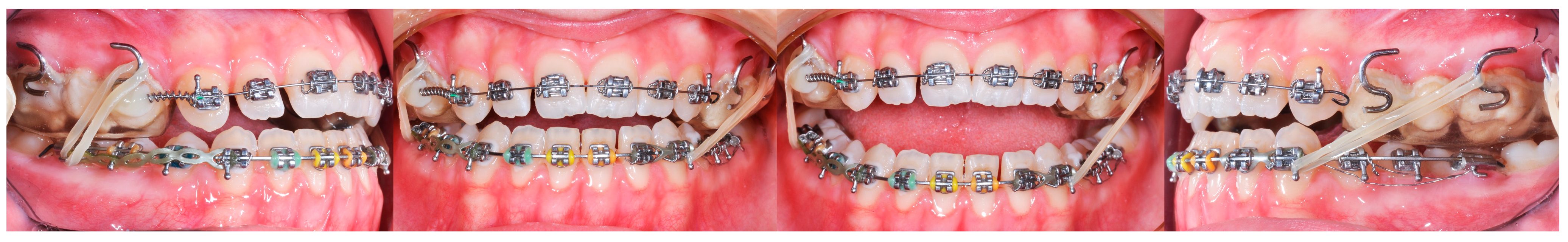 Applsci 14 08095 g011 Applsci 14 08095 g011