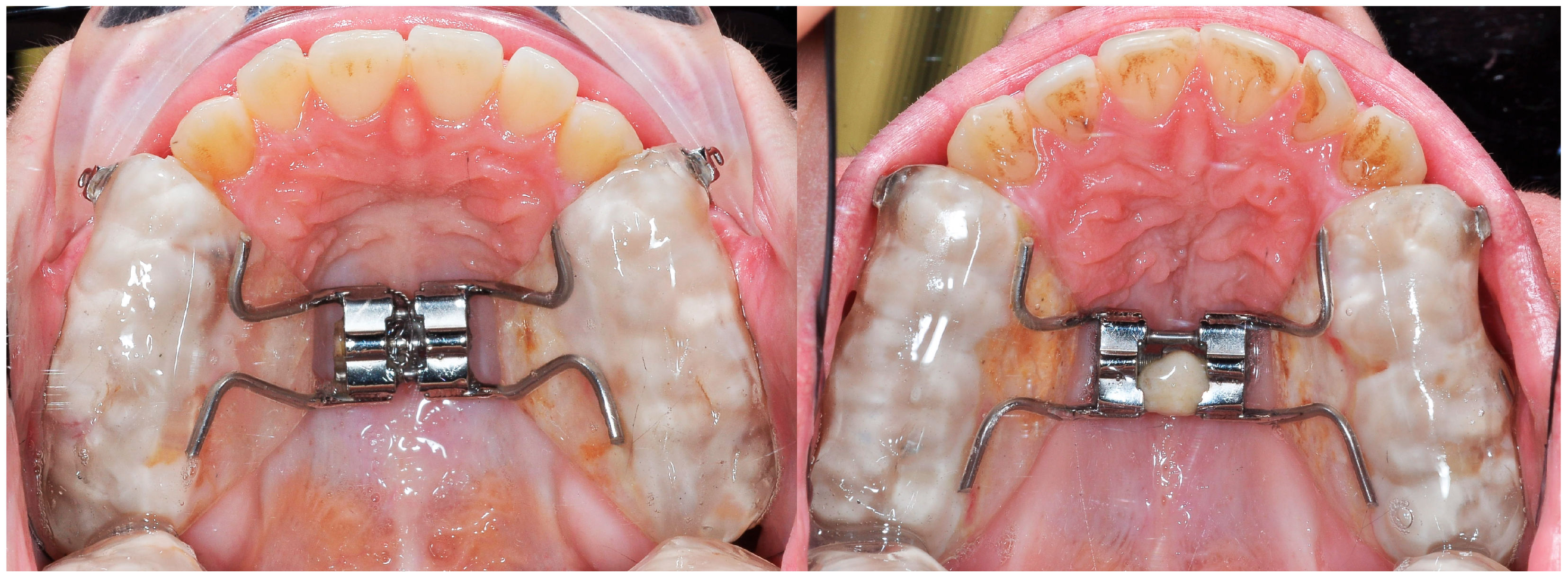 Applsci 14 08095 g012 Applsci 14 08095 g012