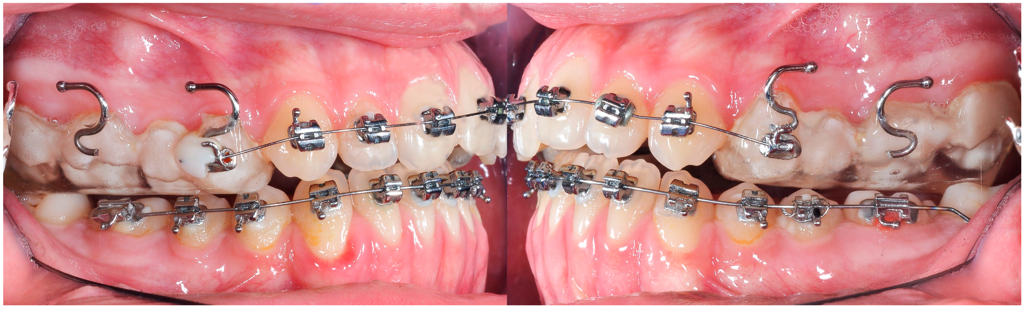 Applsci 14 08095 g014 Applsci 14 08095 g014