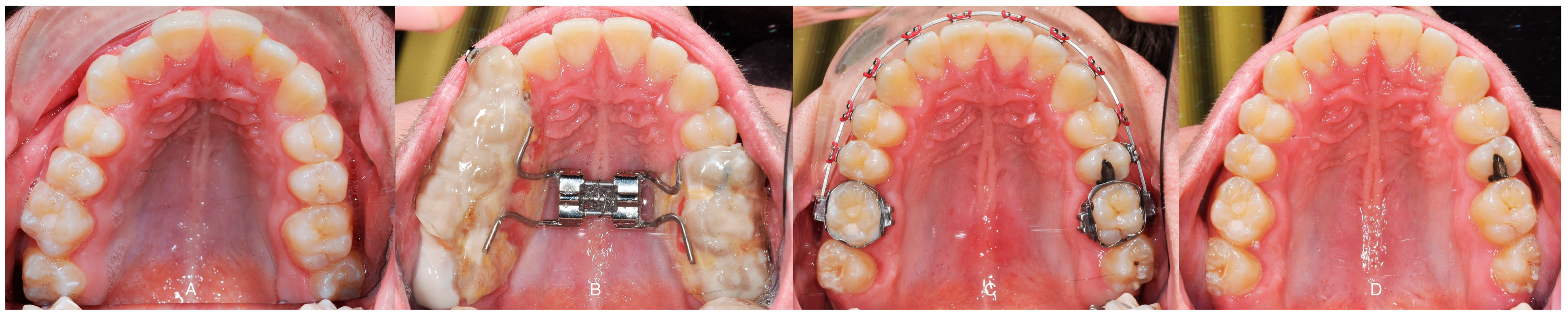 Applsci 14 08095 g015 Applsci 14 08095 g015