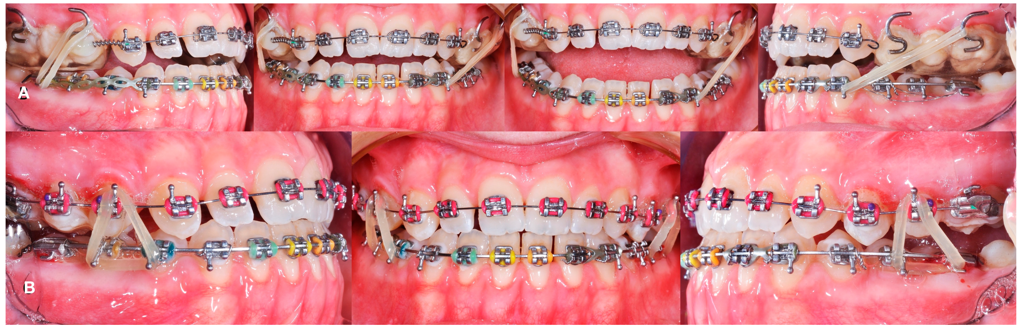 Applsci 14 08095 g016 Applsci 14 08095 g016