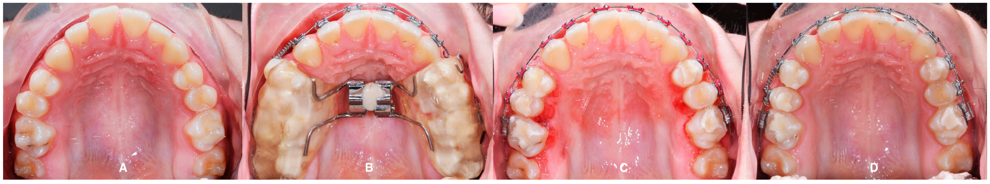 Applsci 14 08095 g017 Applsci 14 08095 g017