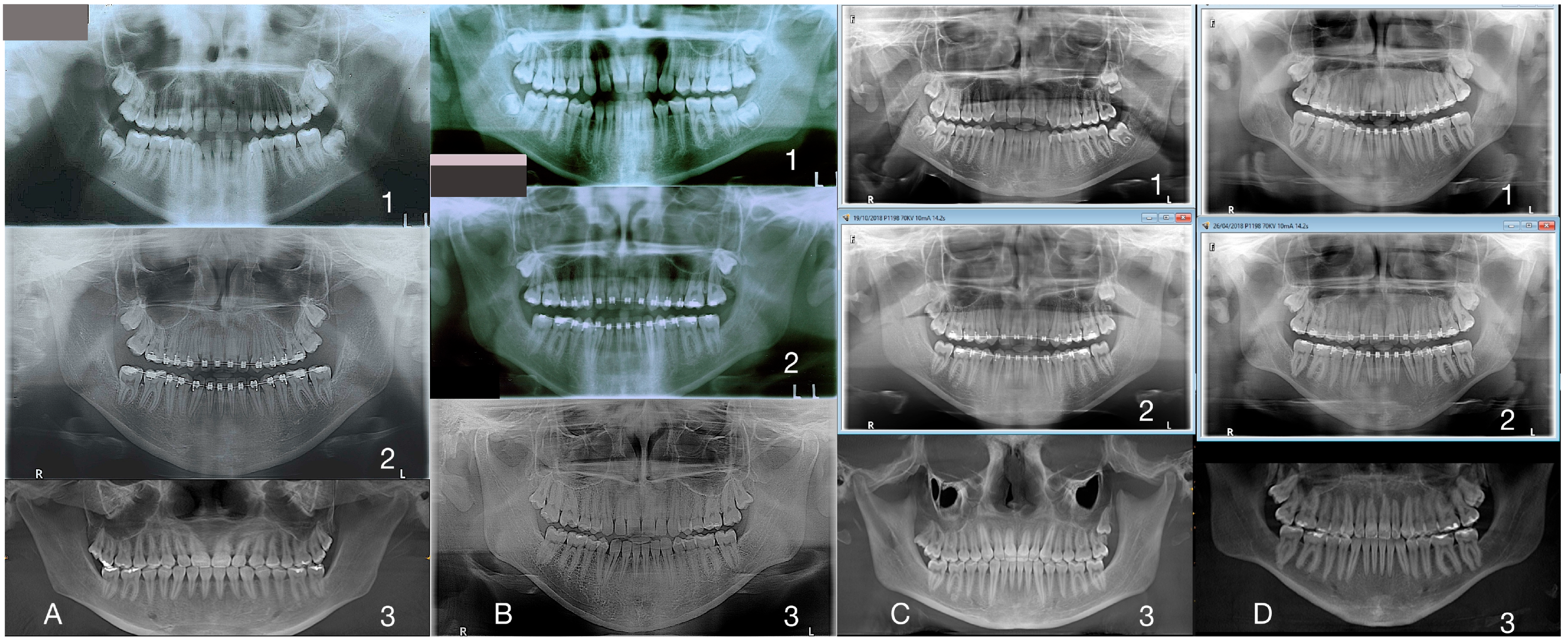 Applsci 14 08095 g021 Applsci 14 08095 g021