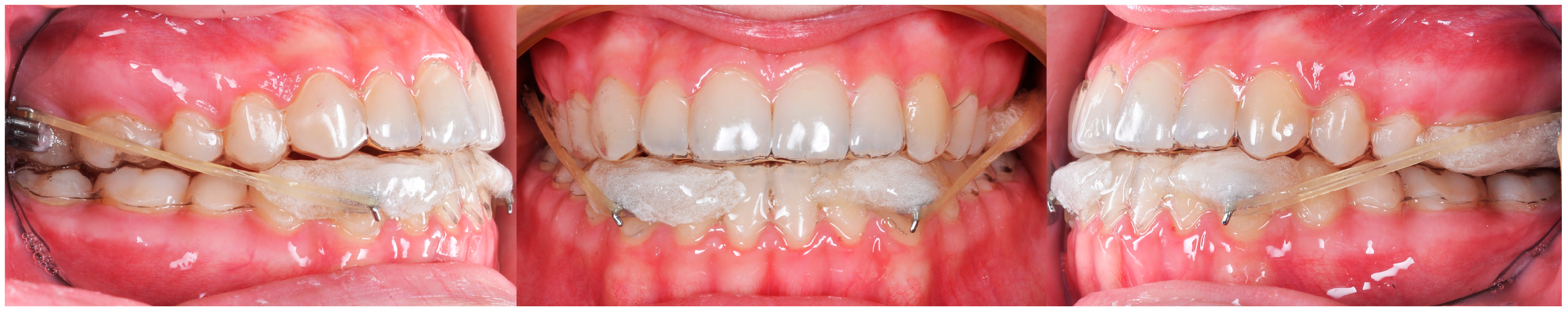 Applsci 14 08095 g023 Applsci 14 08095 g023