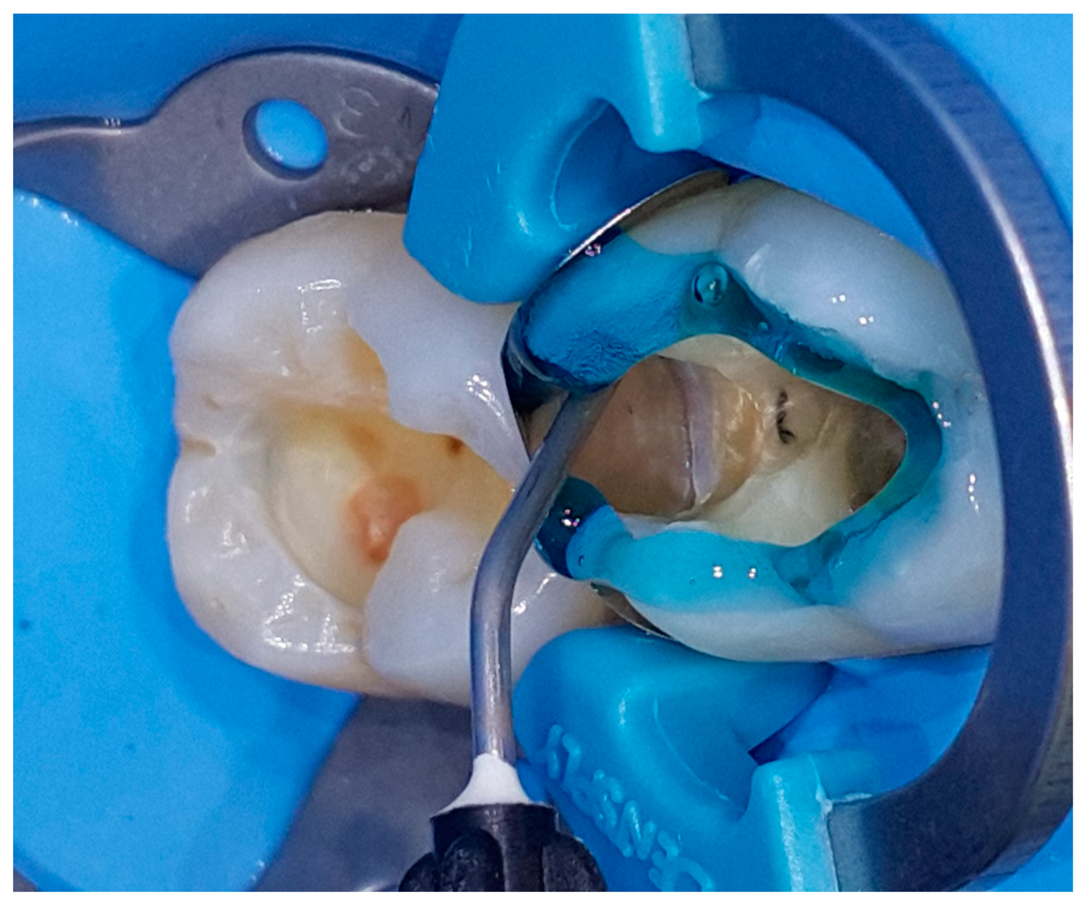 Applsci 14 08111 g017