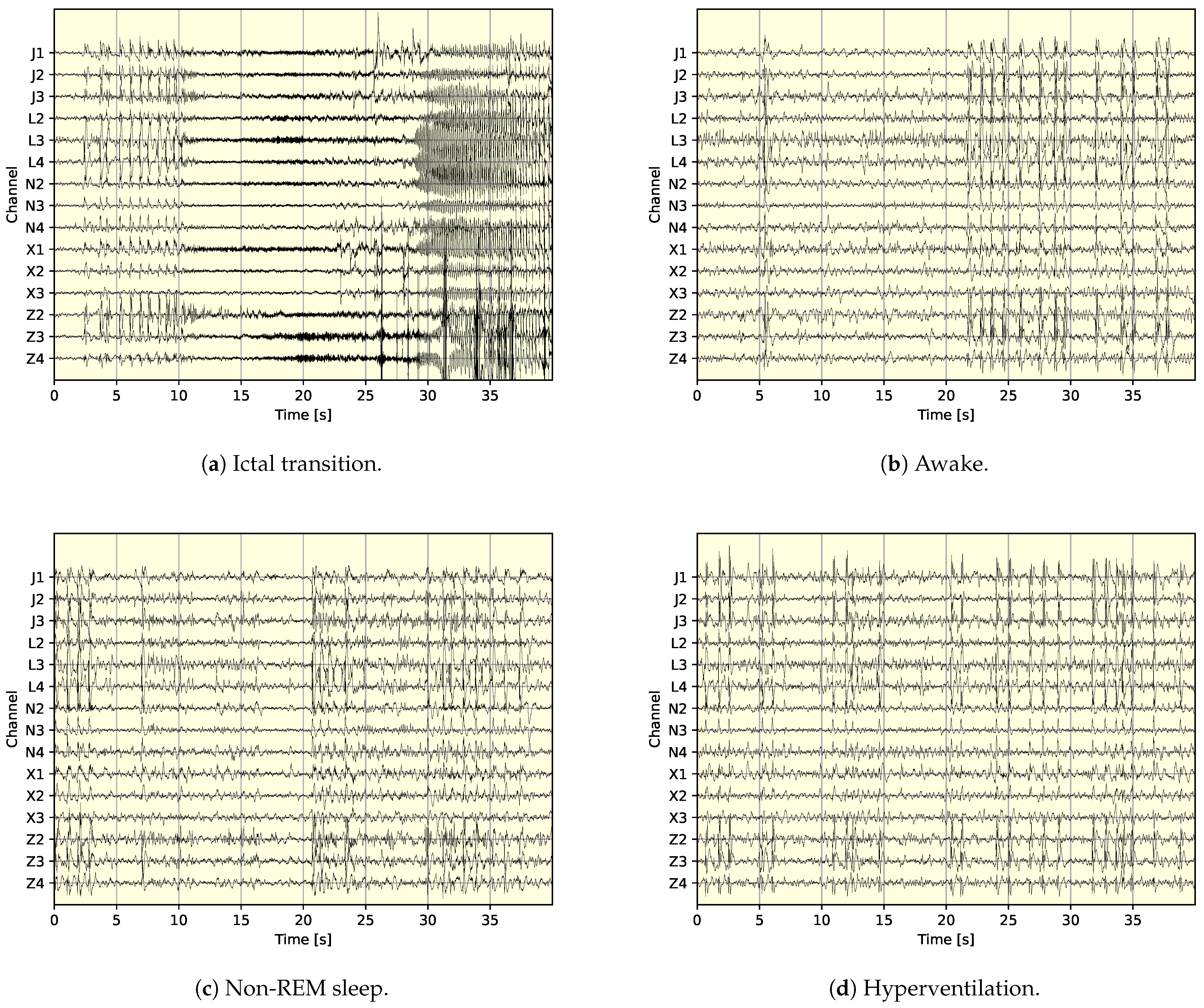 Applsci 14 08494 g001