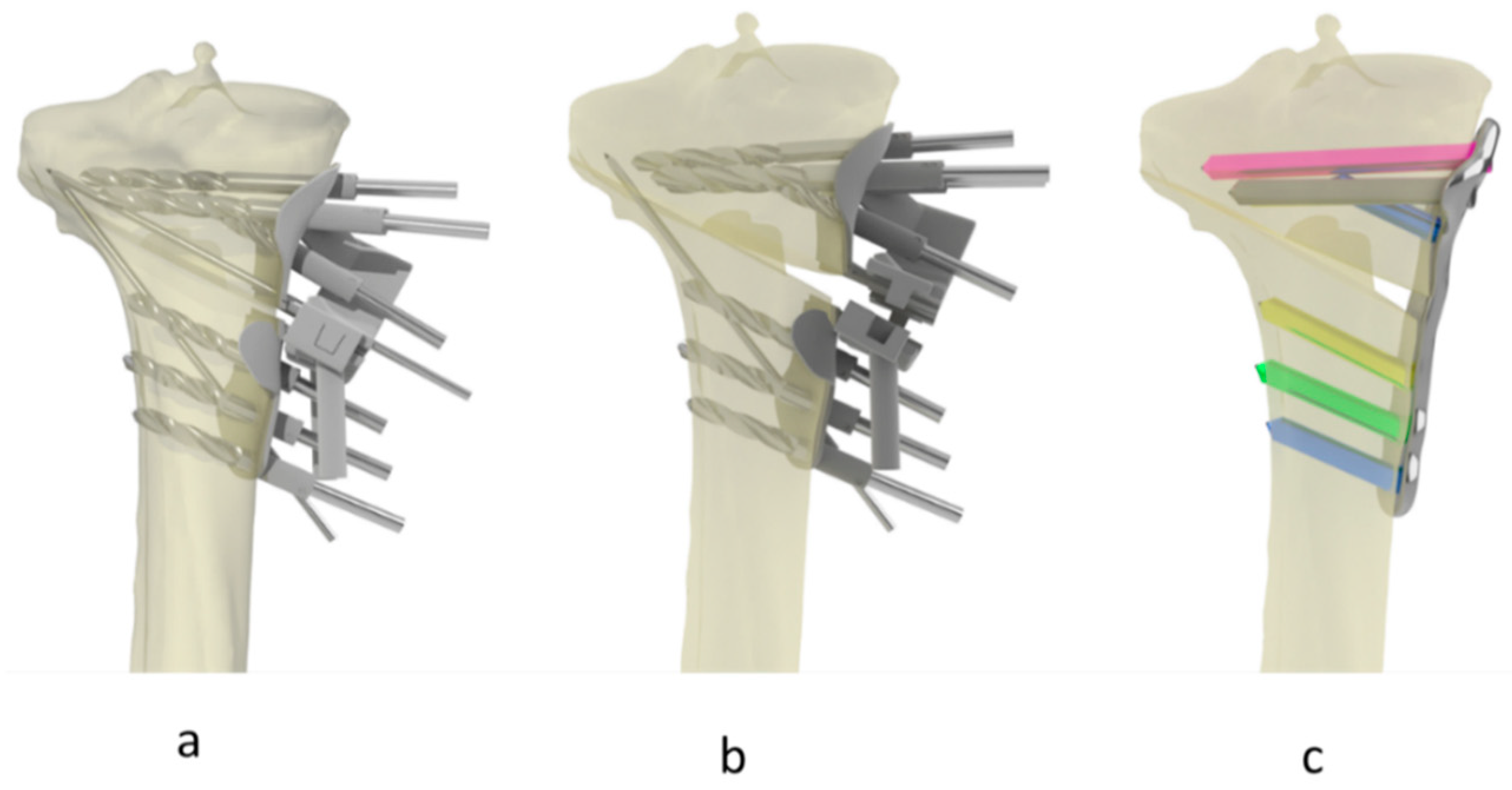 Applsci 14 09033 g001