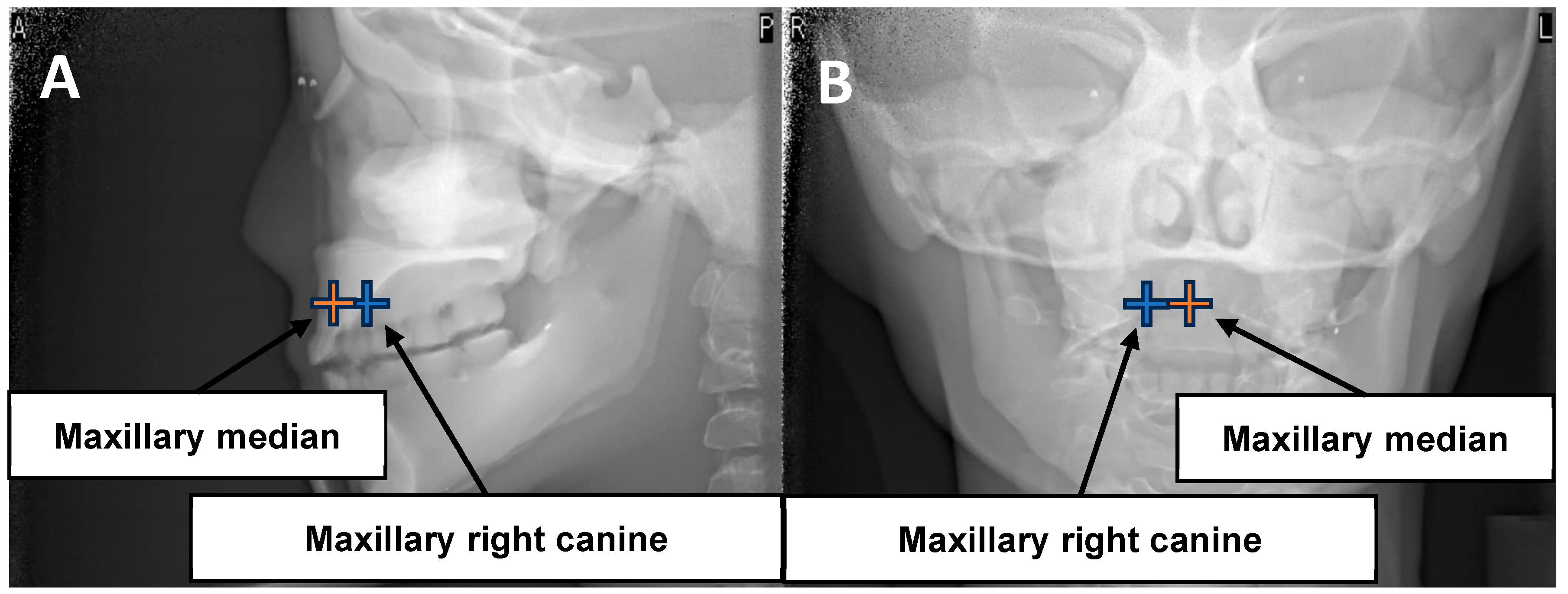 Applsci 14 09154 g003 Applsci 14 09154 g003