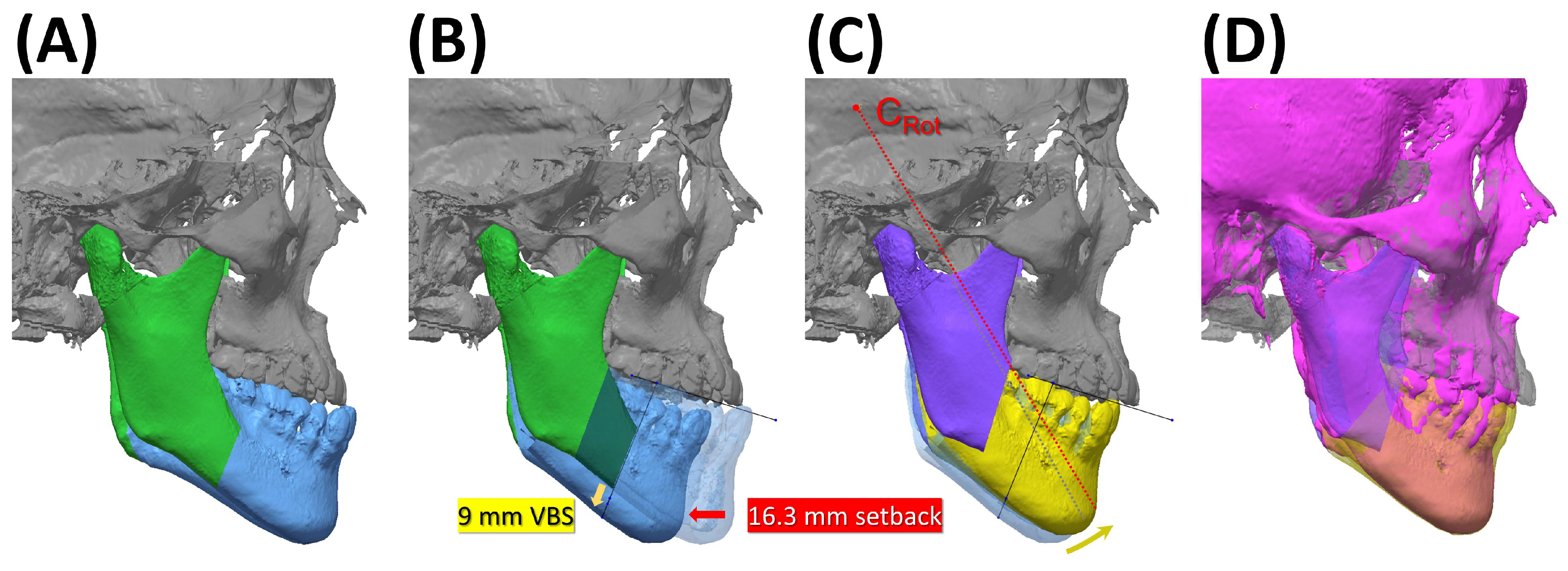 Applsci 14 09299 g006
